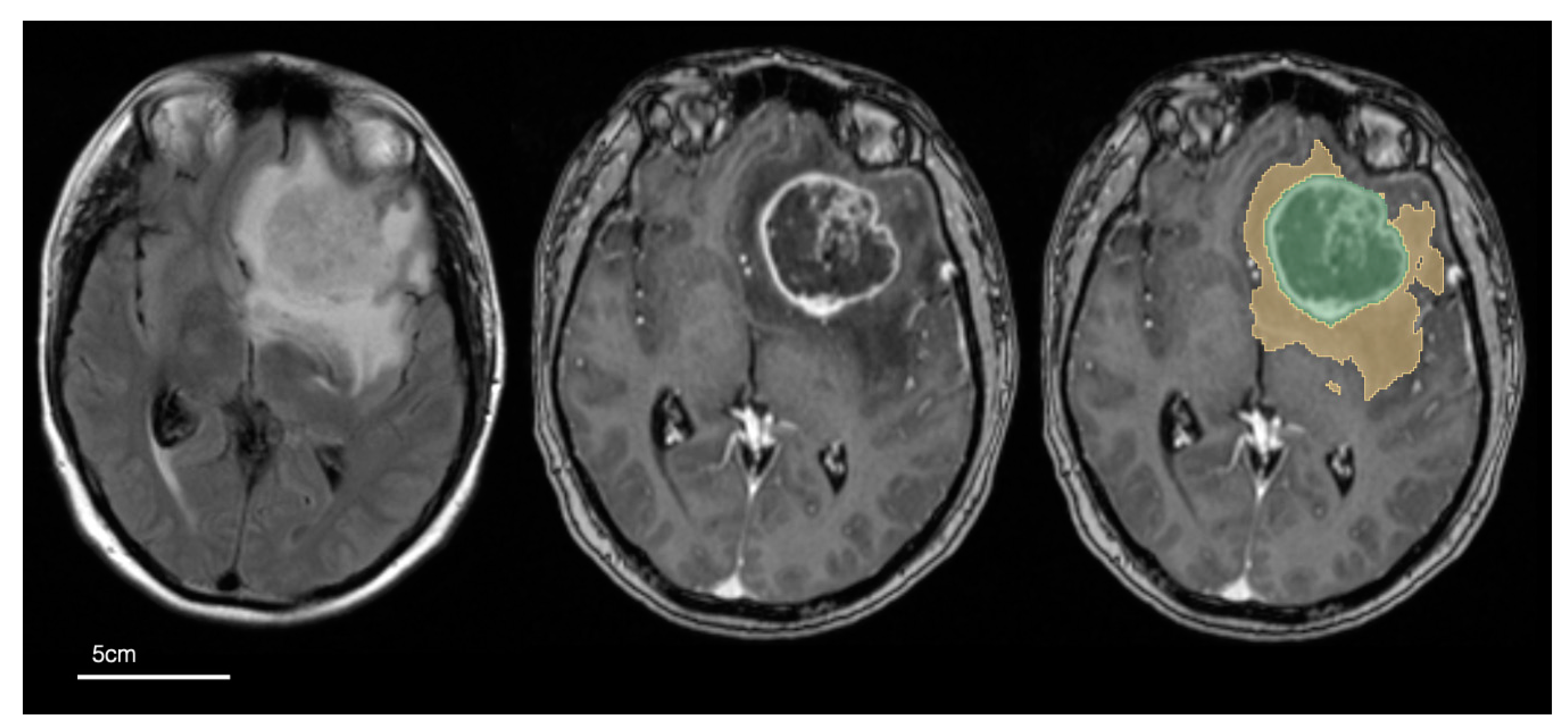 Cancers 16 01301 g002