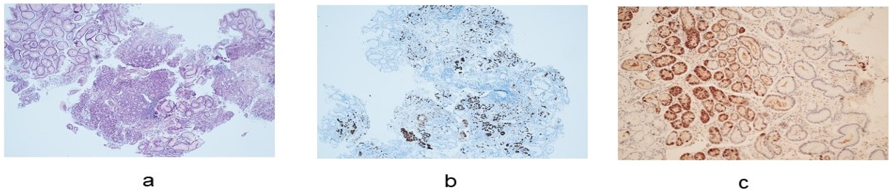 Cancers 16 01310 g002