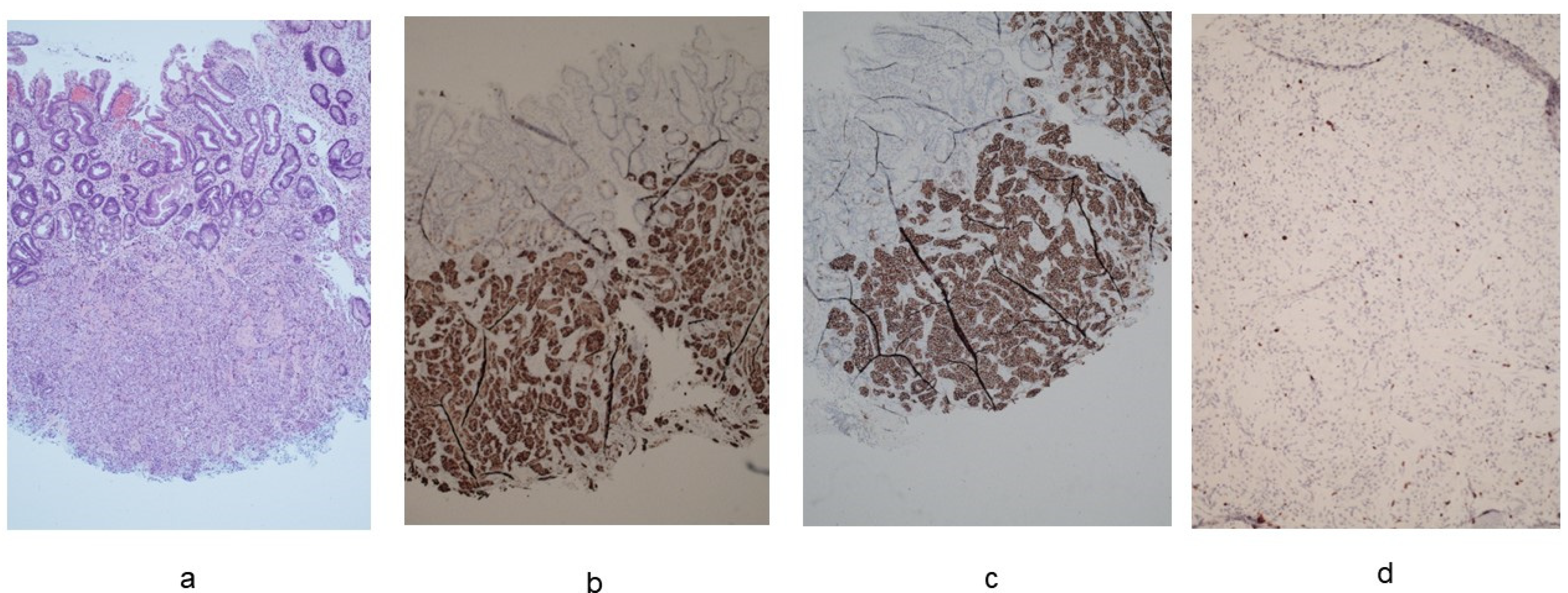 Cancers 16 01310 g003