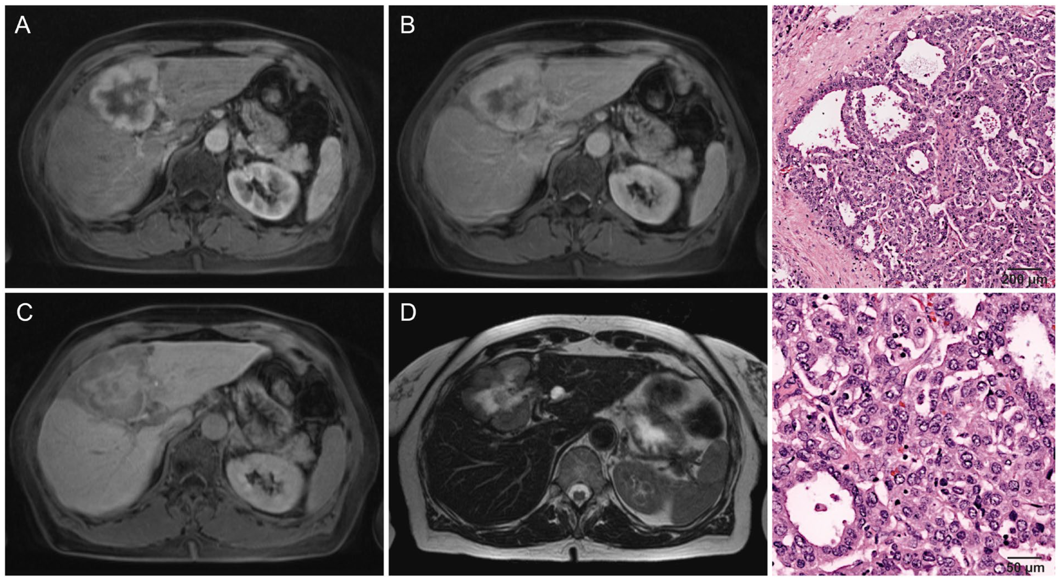 Cancers 16 01314 g002