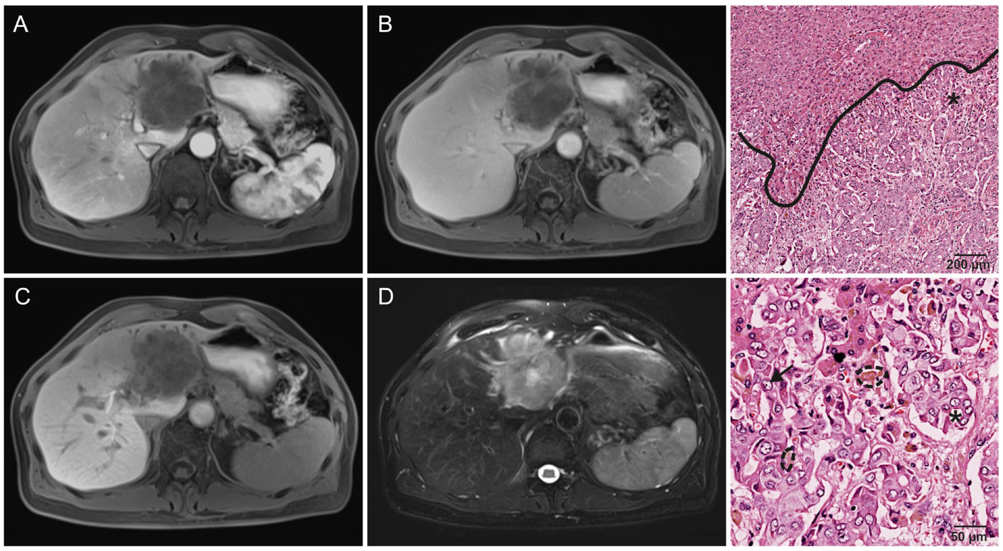 Cancers 16 01314 g003