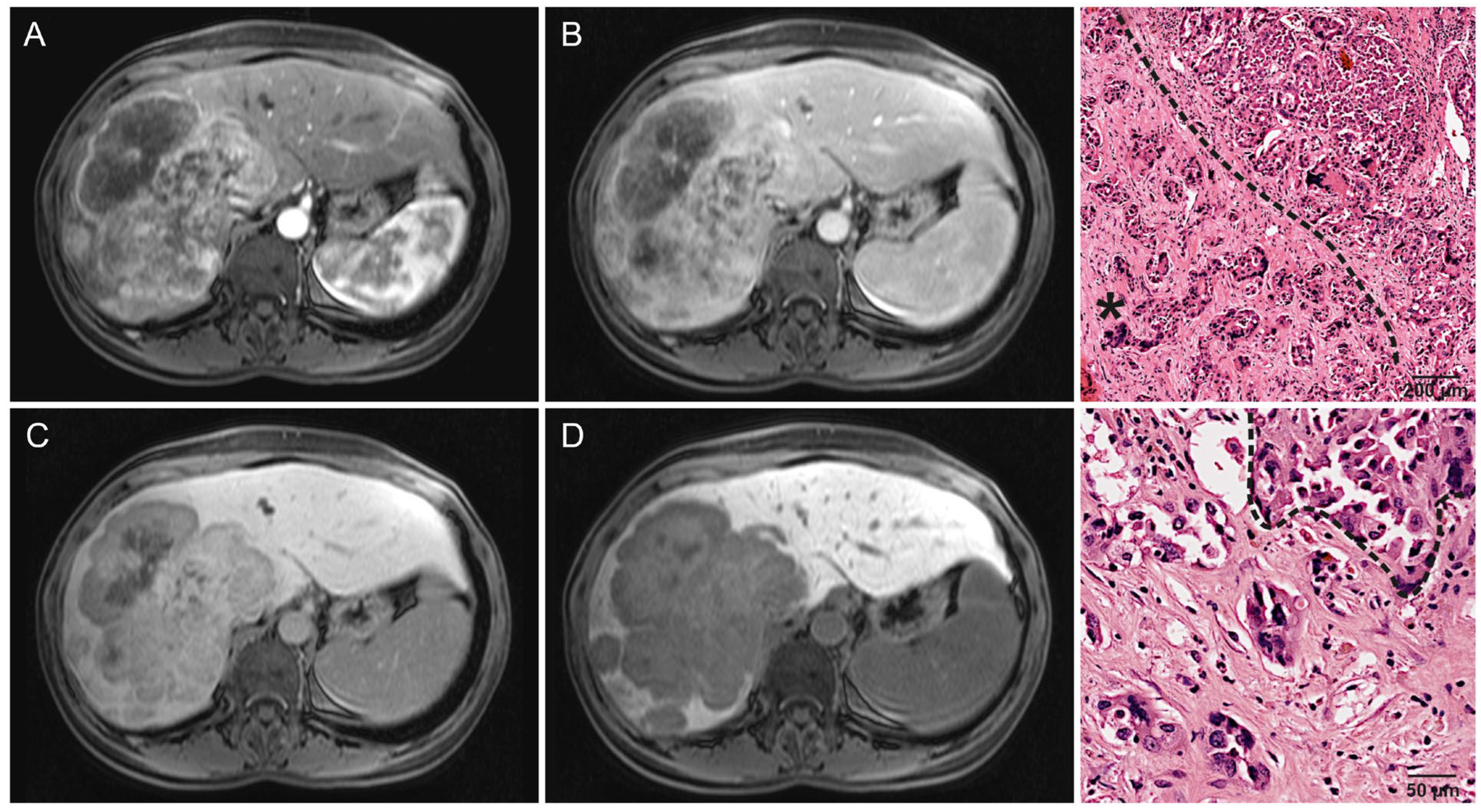 Cancers 16 01314 g004