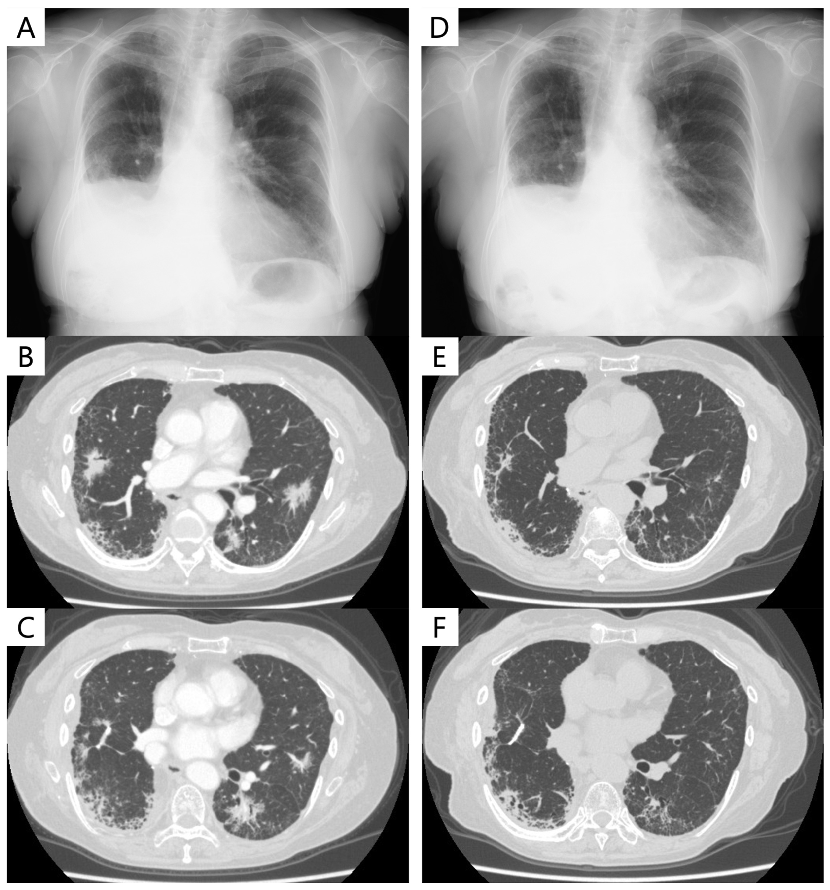 Cancers 16 01327 g002