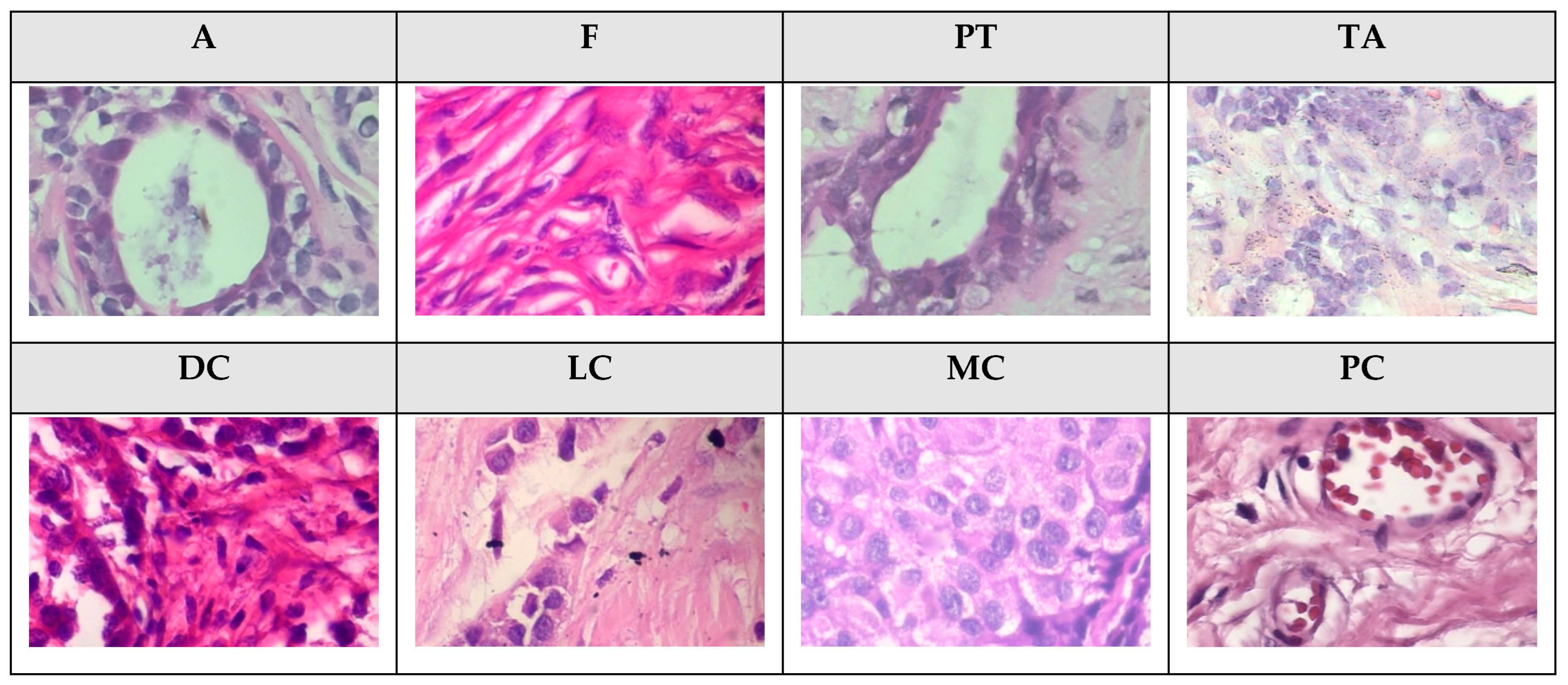 Cancers 16 01362 g004