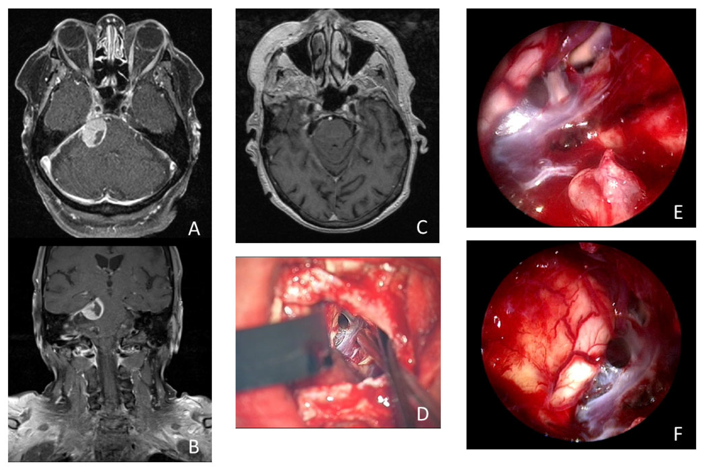 Cancers 16 01391 g003