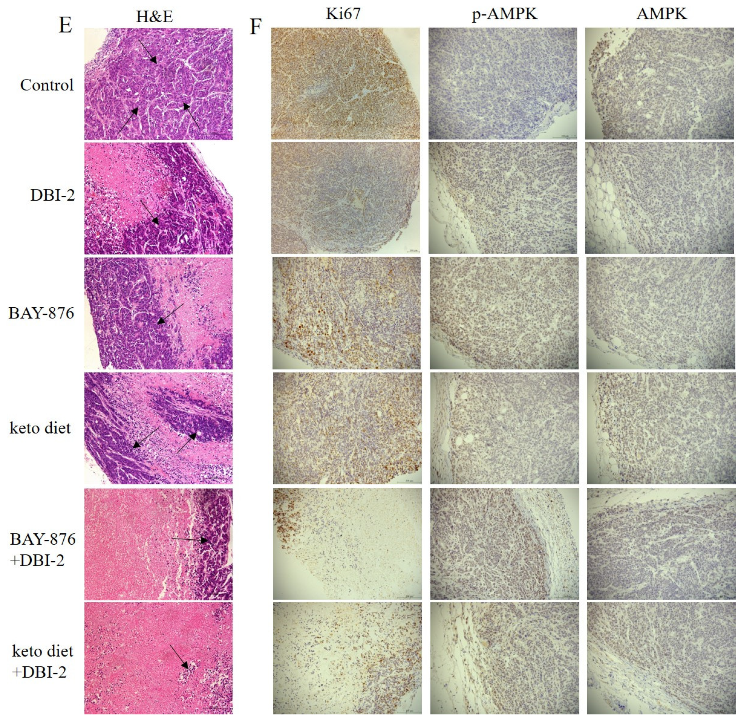 Cancers 16 01399 g008b Cancers 16 01399 g008b