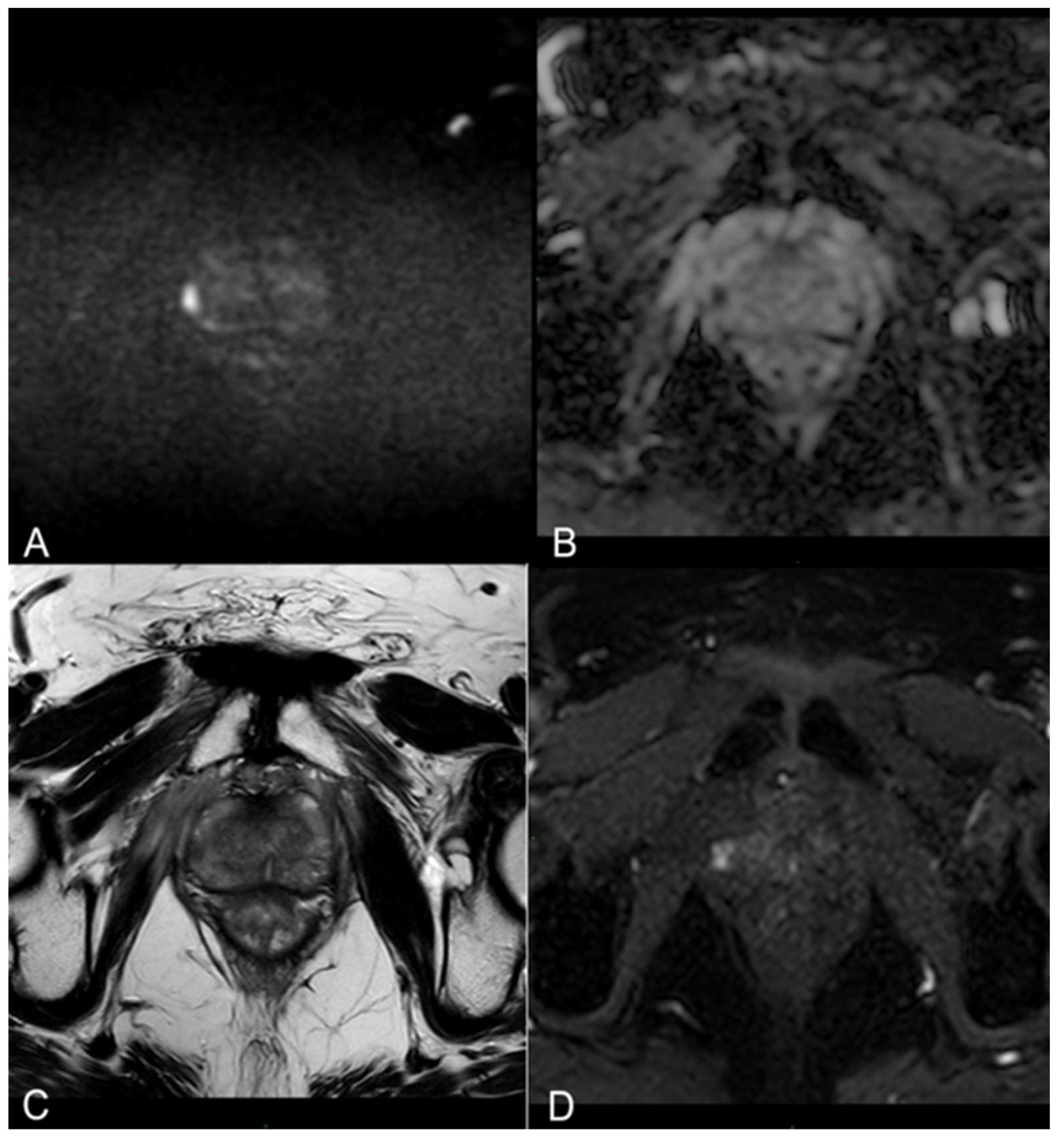 Cancers 16 01404 g001