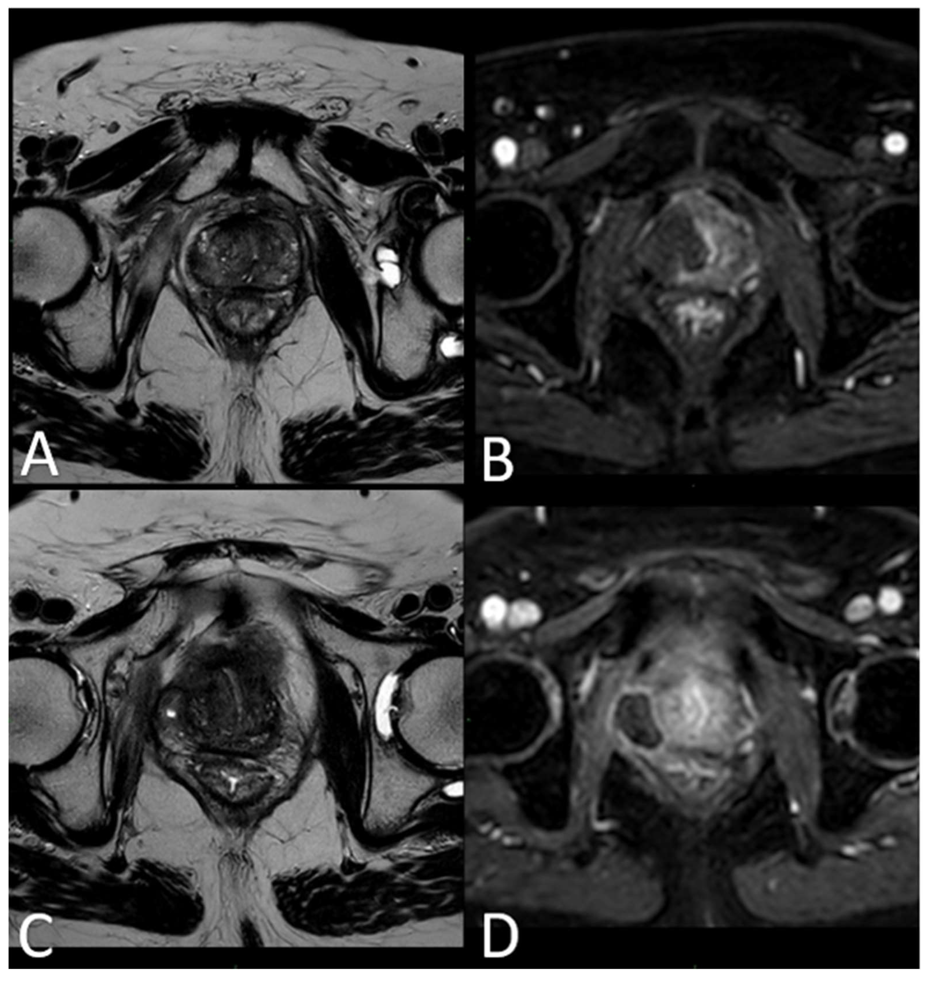 Cancers 16 01404 g003