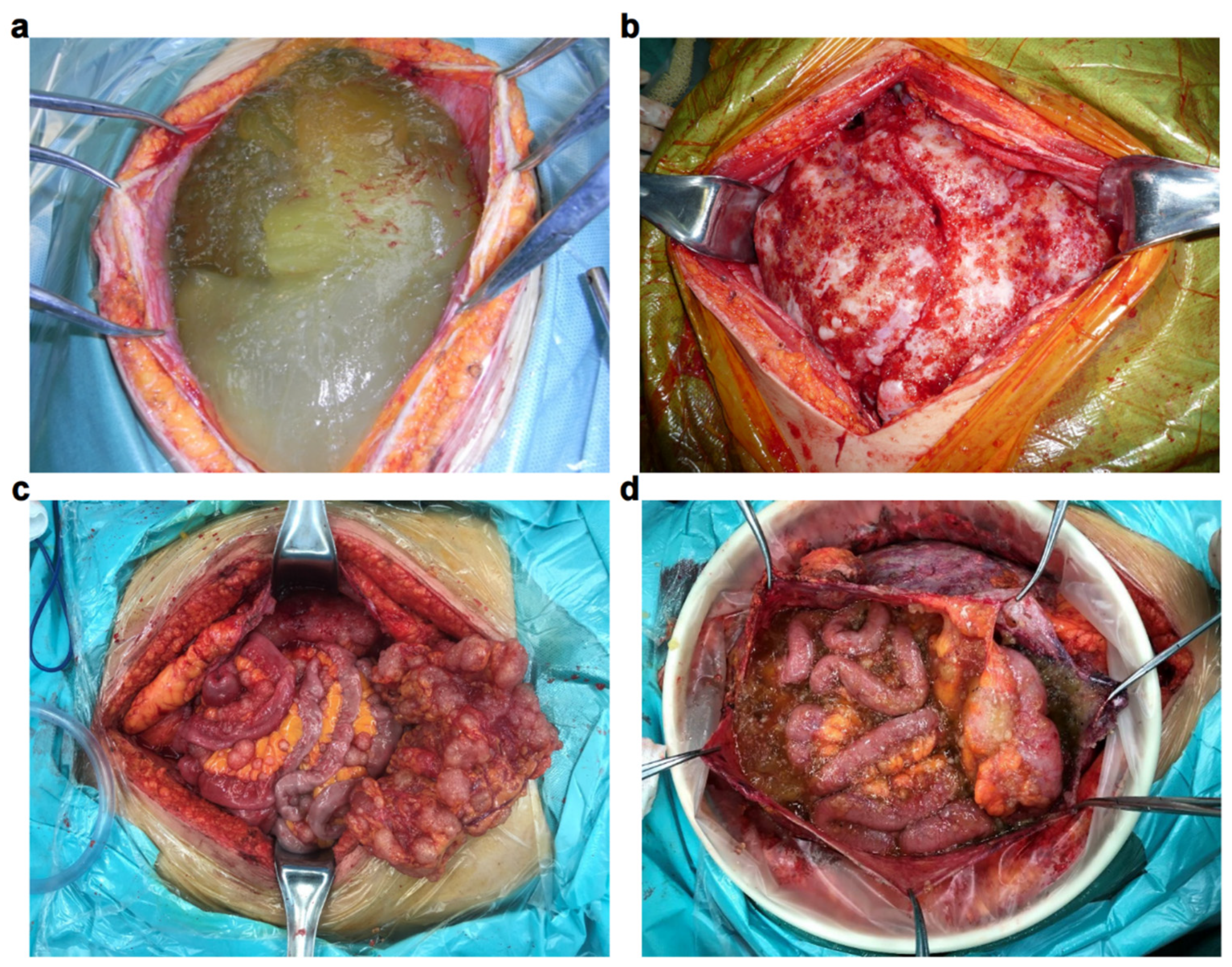 Cancers 16 01406 g002 Cancers 16 01406 g002