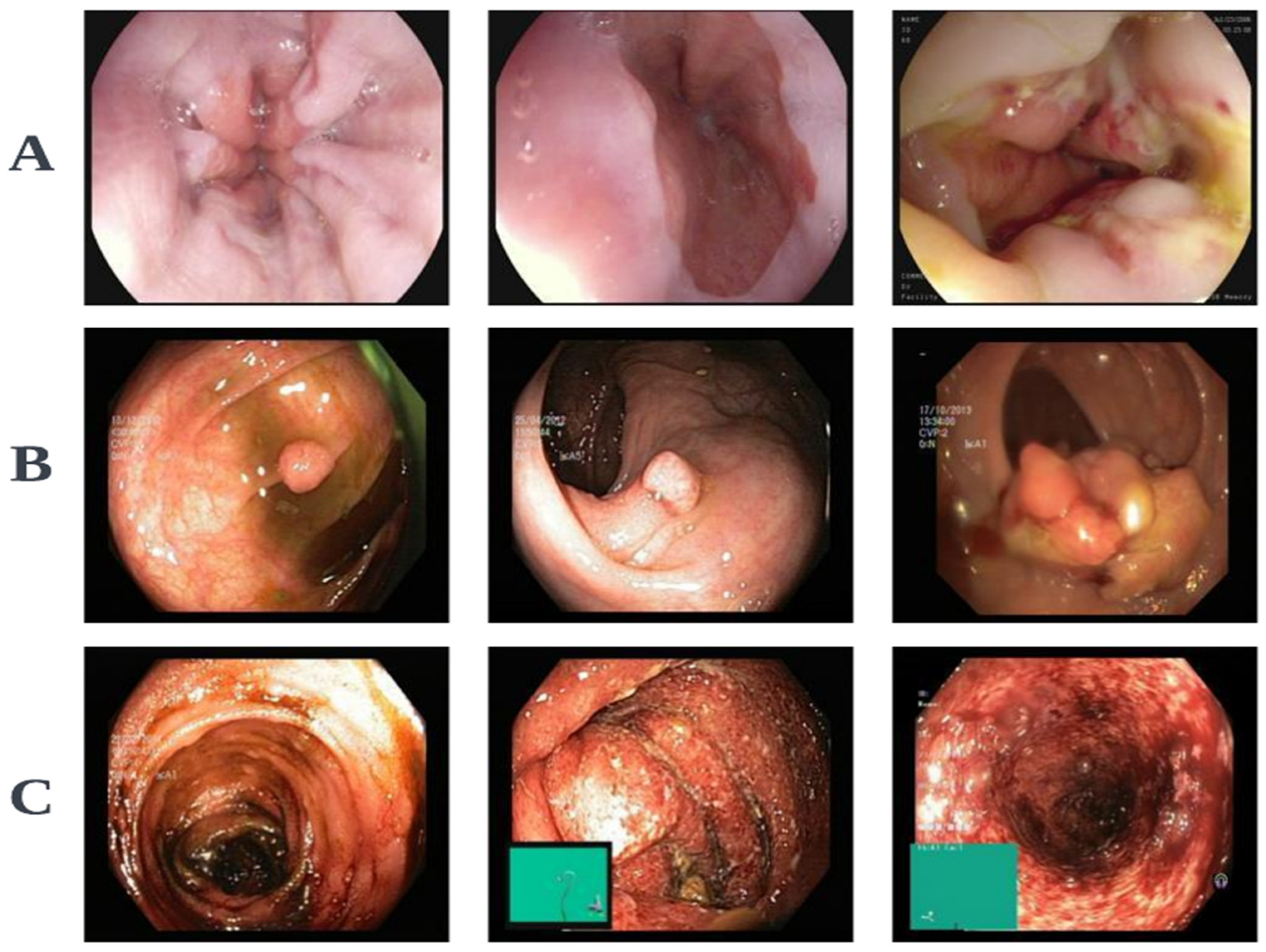 Cancers 16 01441 g004 Cancers 16 01441 g004