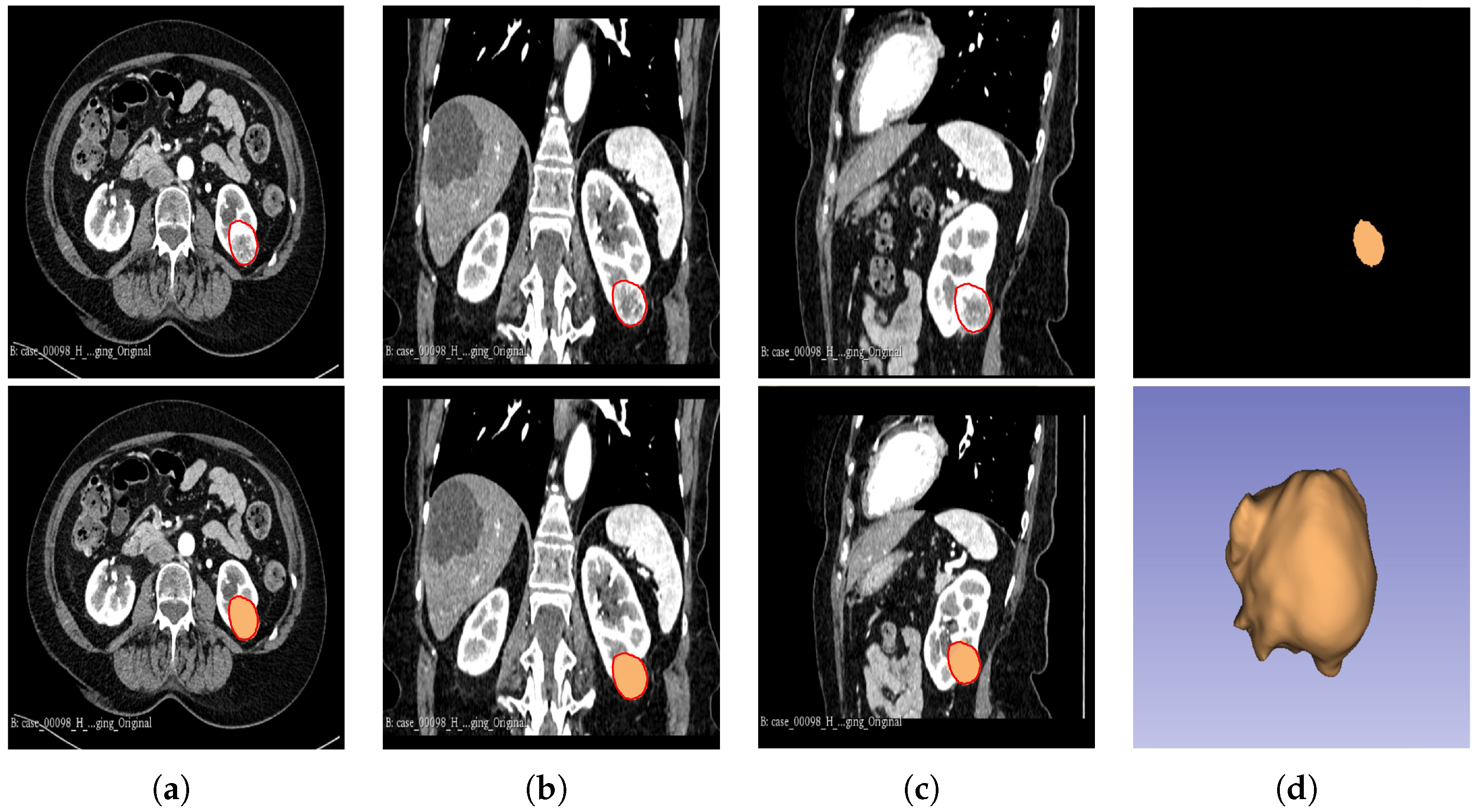 Cancers 16 01454 g002 Cancers 16 01454 g002