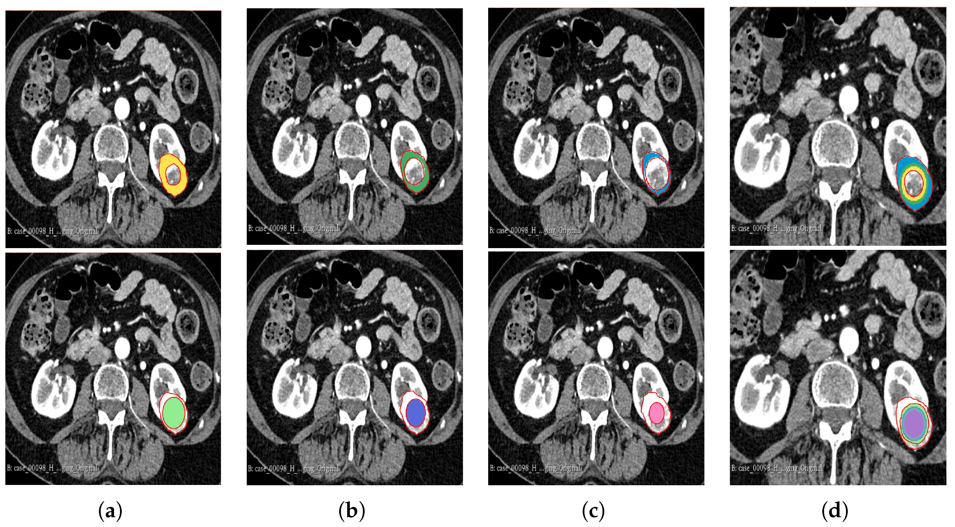 Cancers 16 01454 g003 Cancers 16 01454 g003