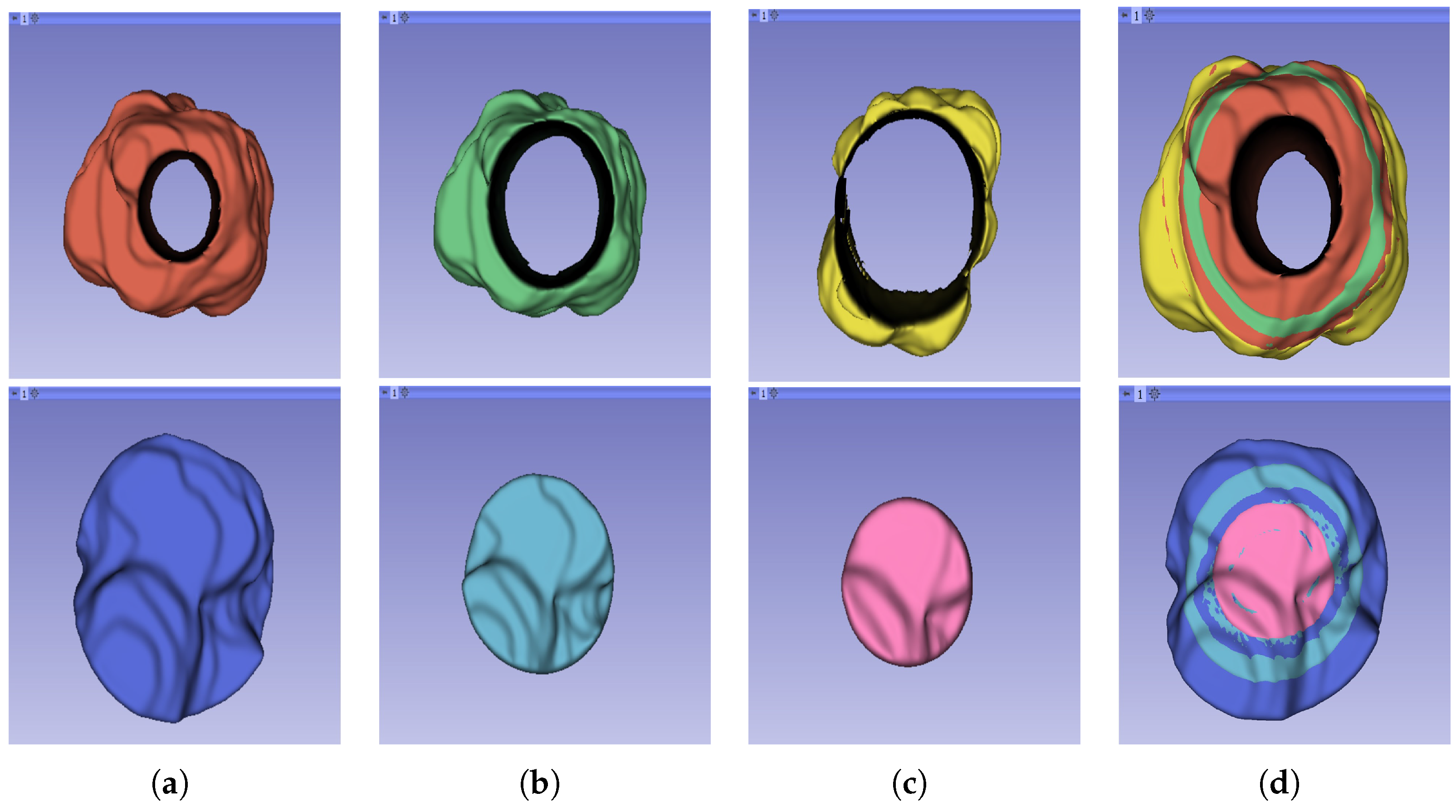 Cancers 16 01454 g004 Cancers 16 01454 g004