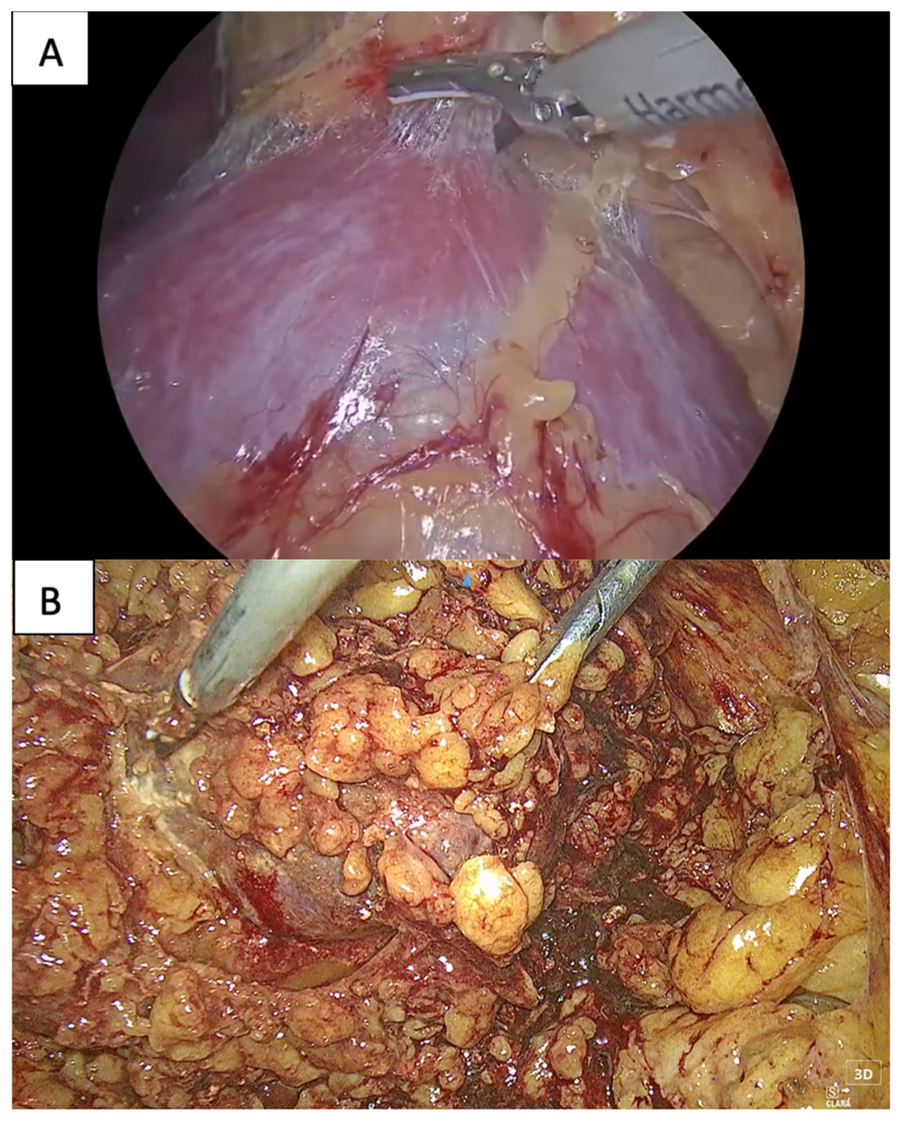Cancers 16 01455 g001