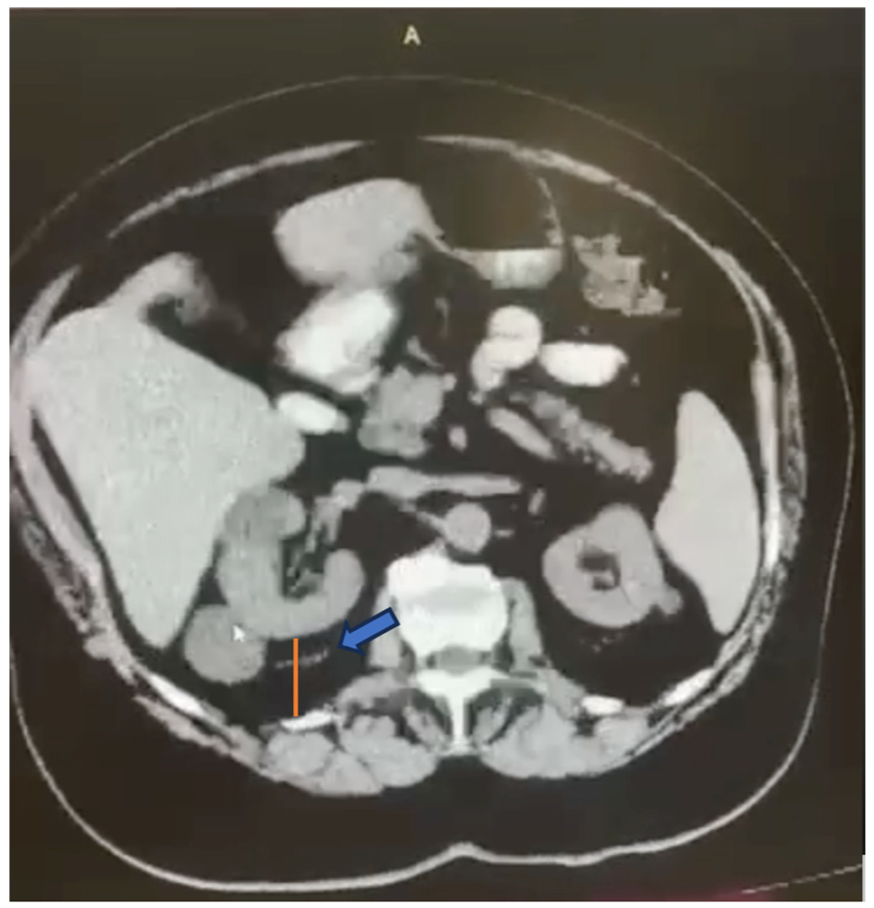 Cancers 16 01455 g002