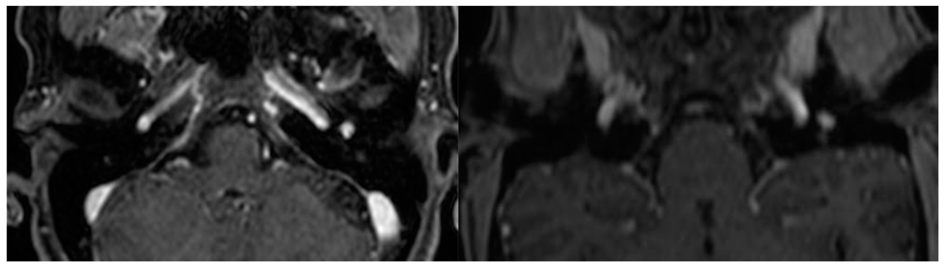 Cancers 16 01466 g003