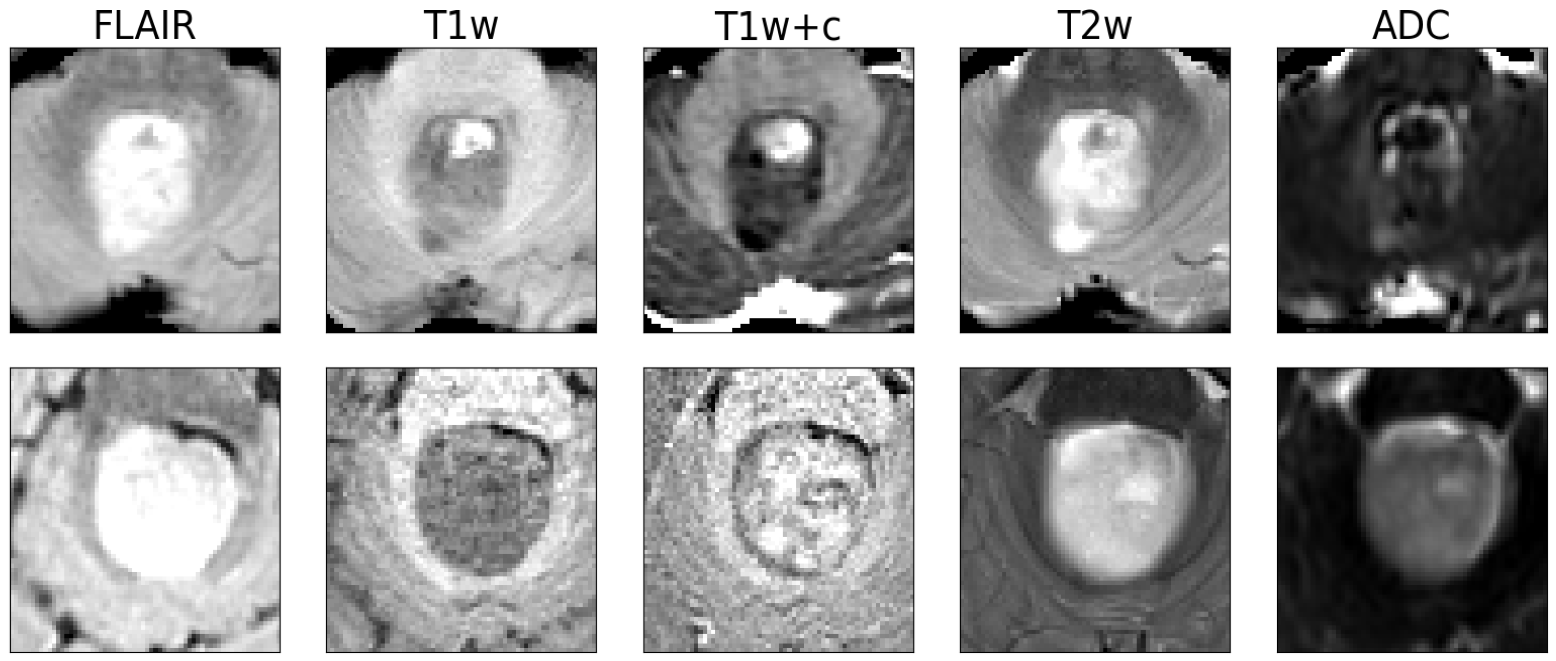 Cancers 16 01474 g002