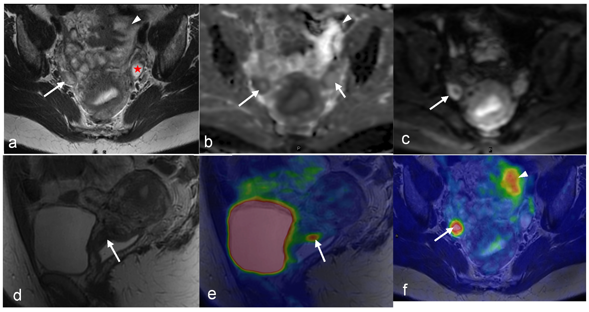 Cancers 16 01478 g002