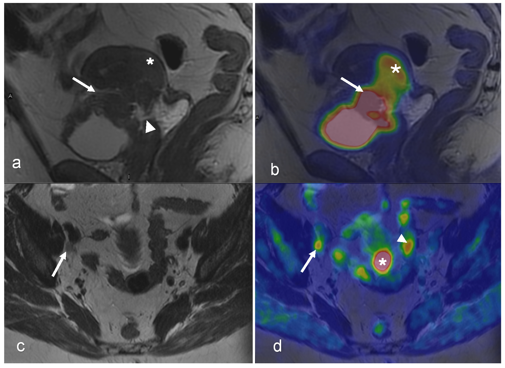 Cancers 16 01478 g004