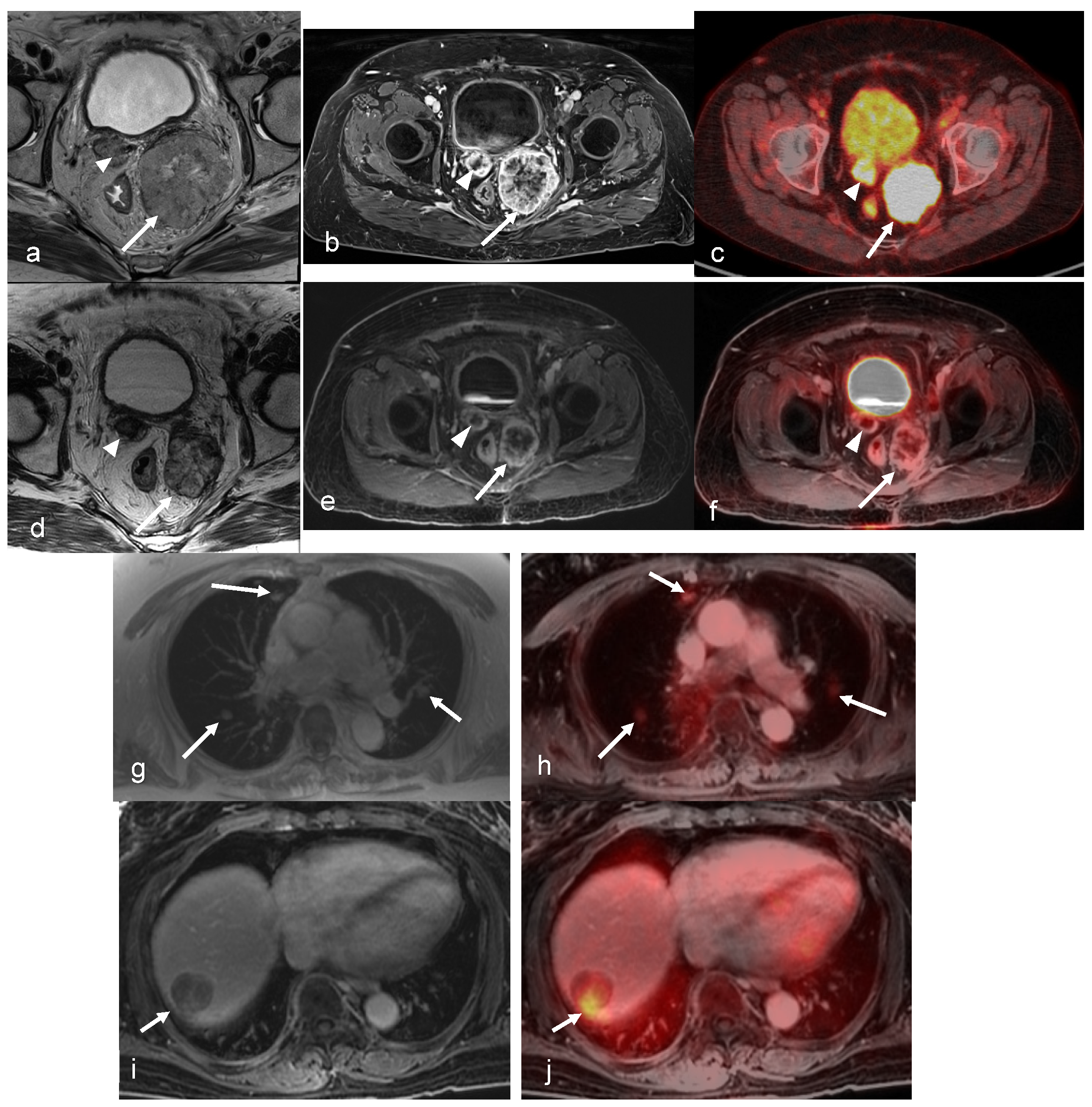 Cancers 16 01478 g006