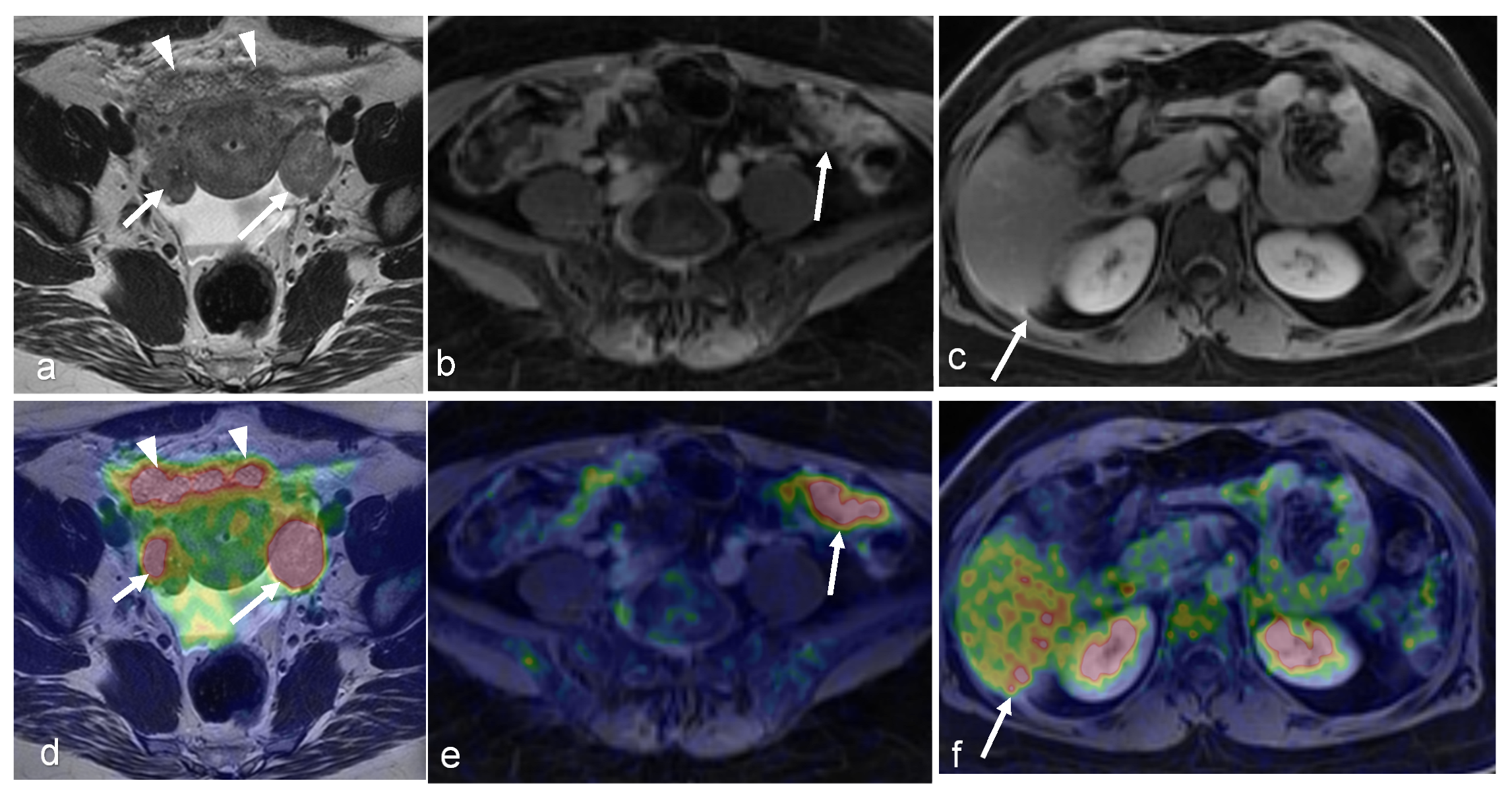 Cancers 16 01478 g008