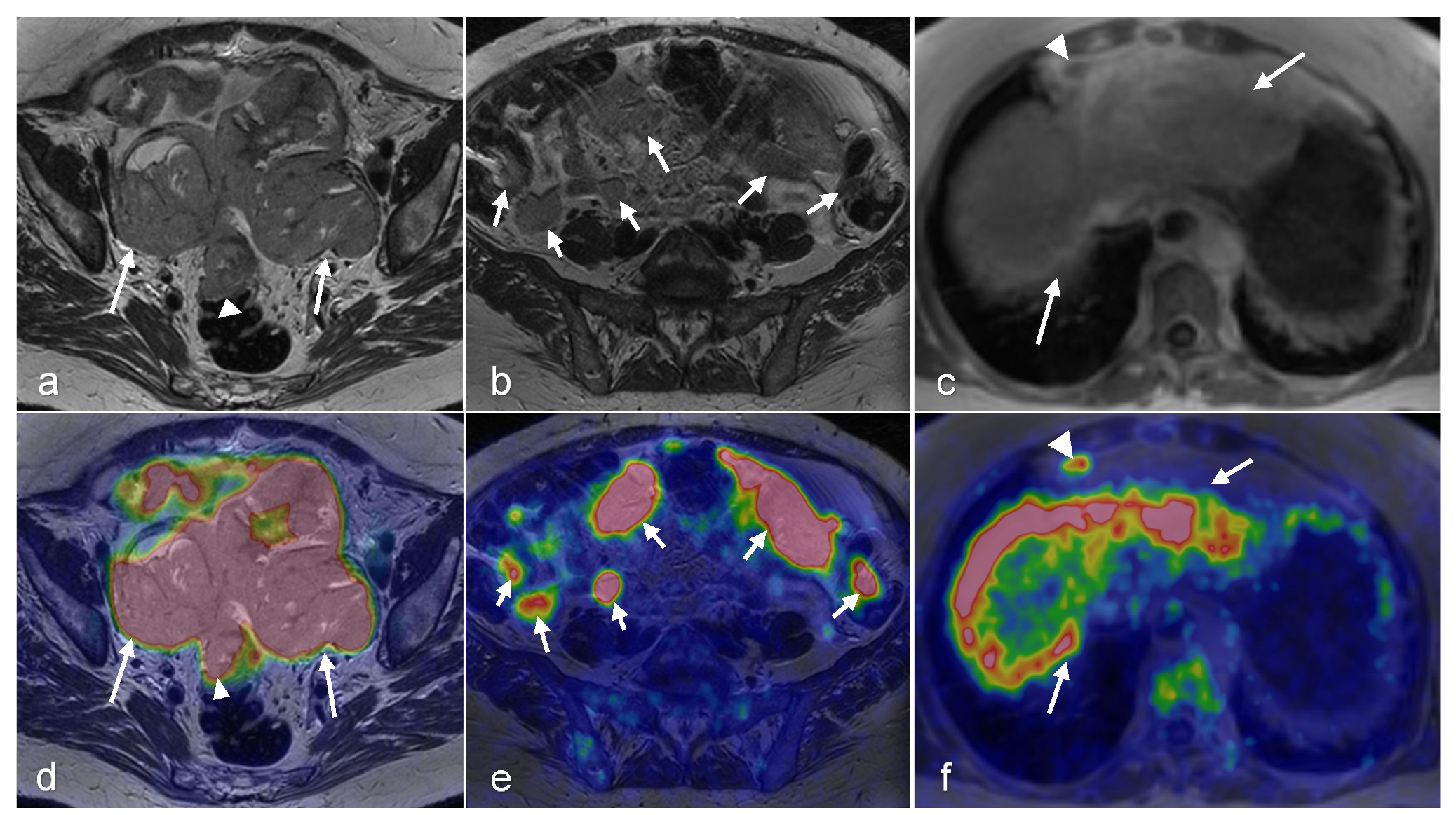 Cancers 16 01478 g009