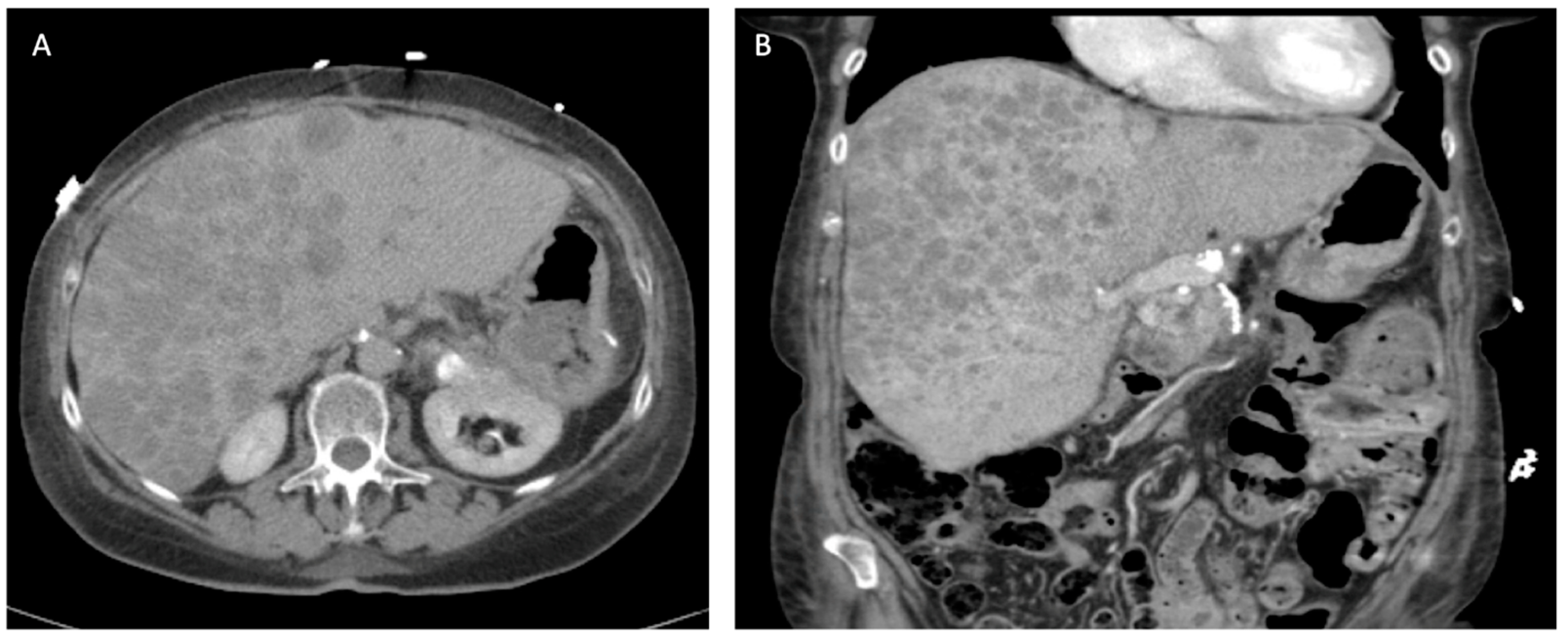 Cancers 16 01501 g006