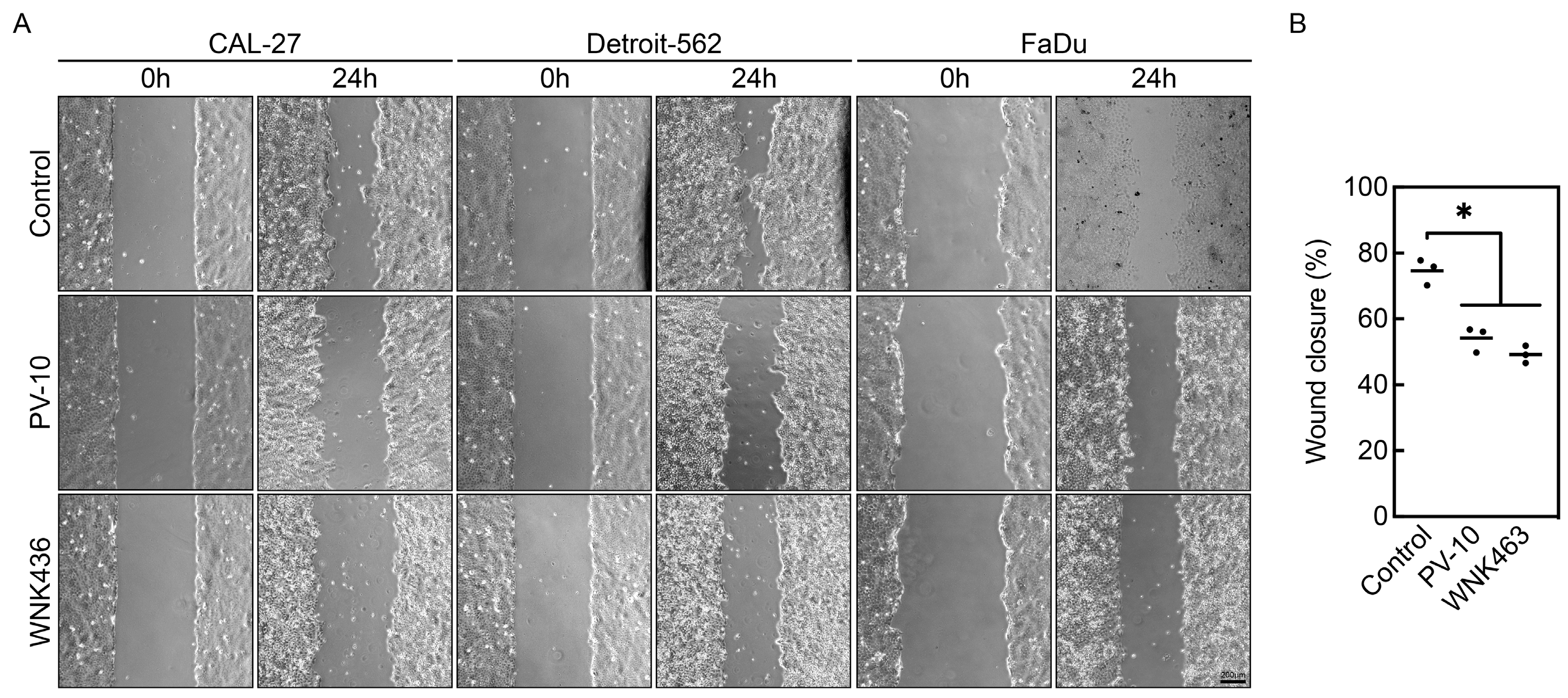 Cancers 16 01520 g004