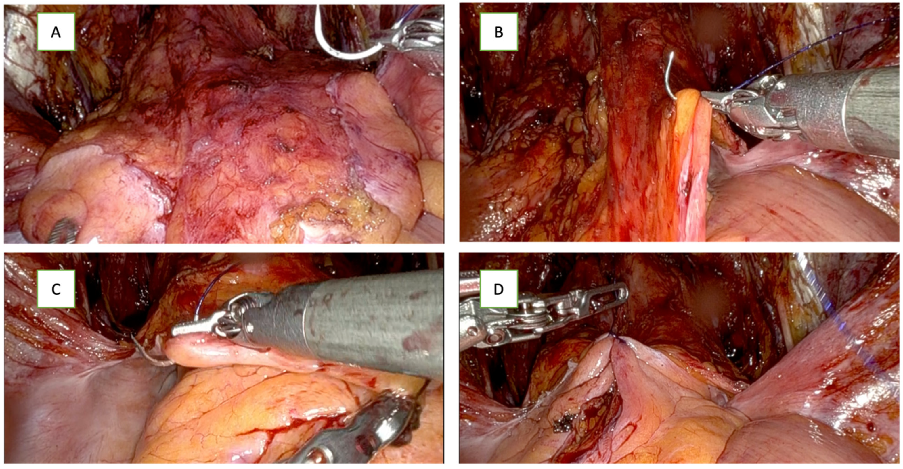 Cancers 16 01547 g002a