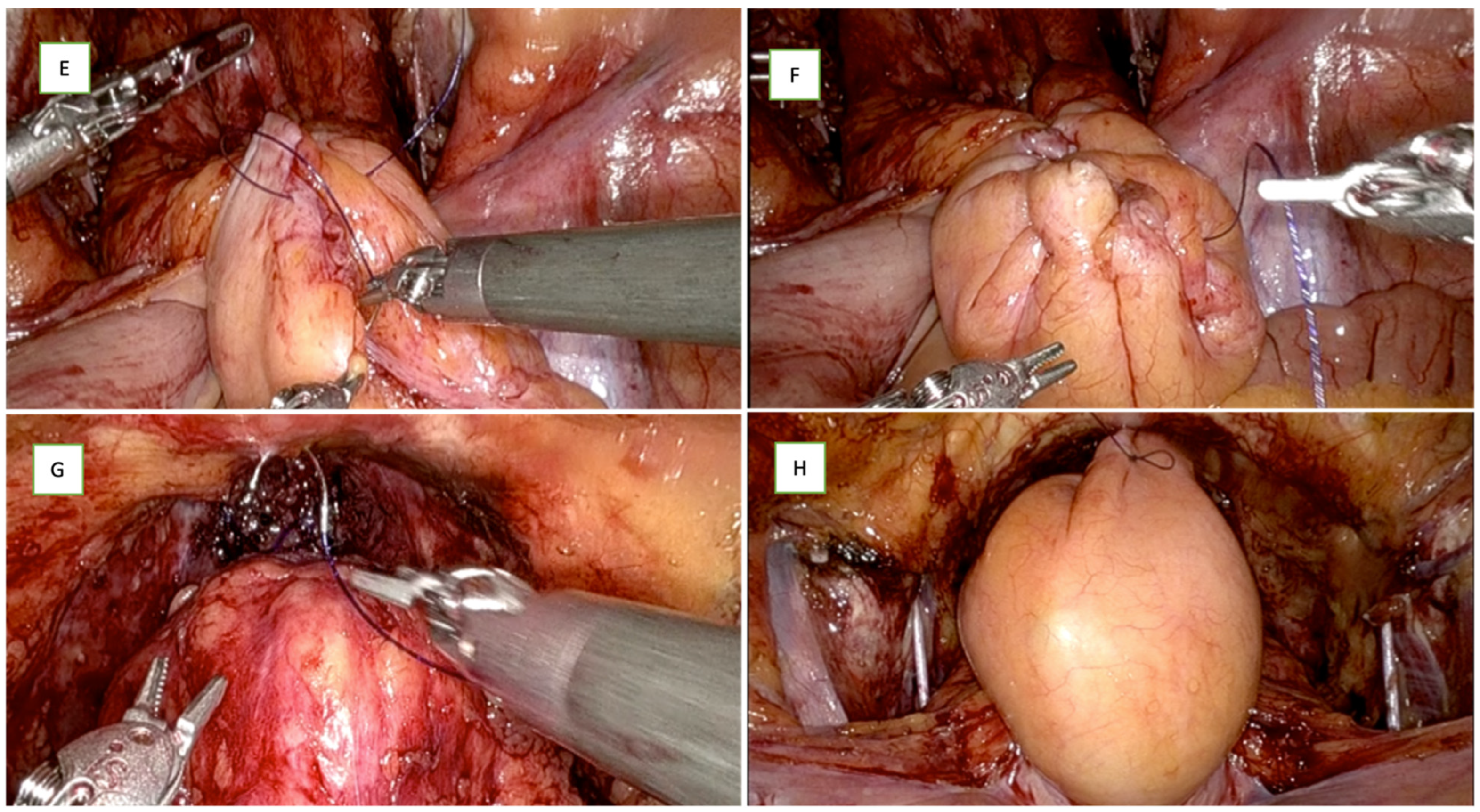 Cancers 16 01547 g002b