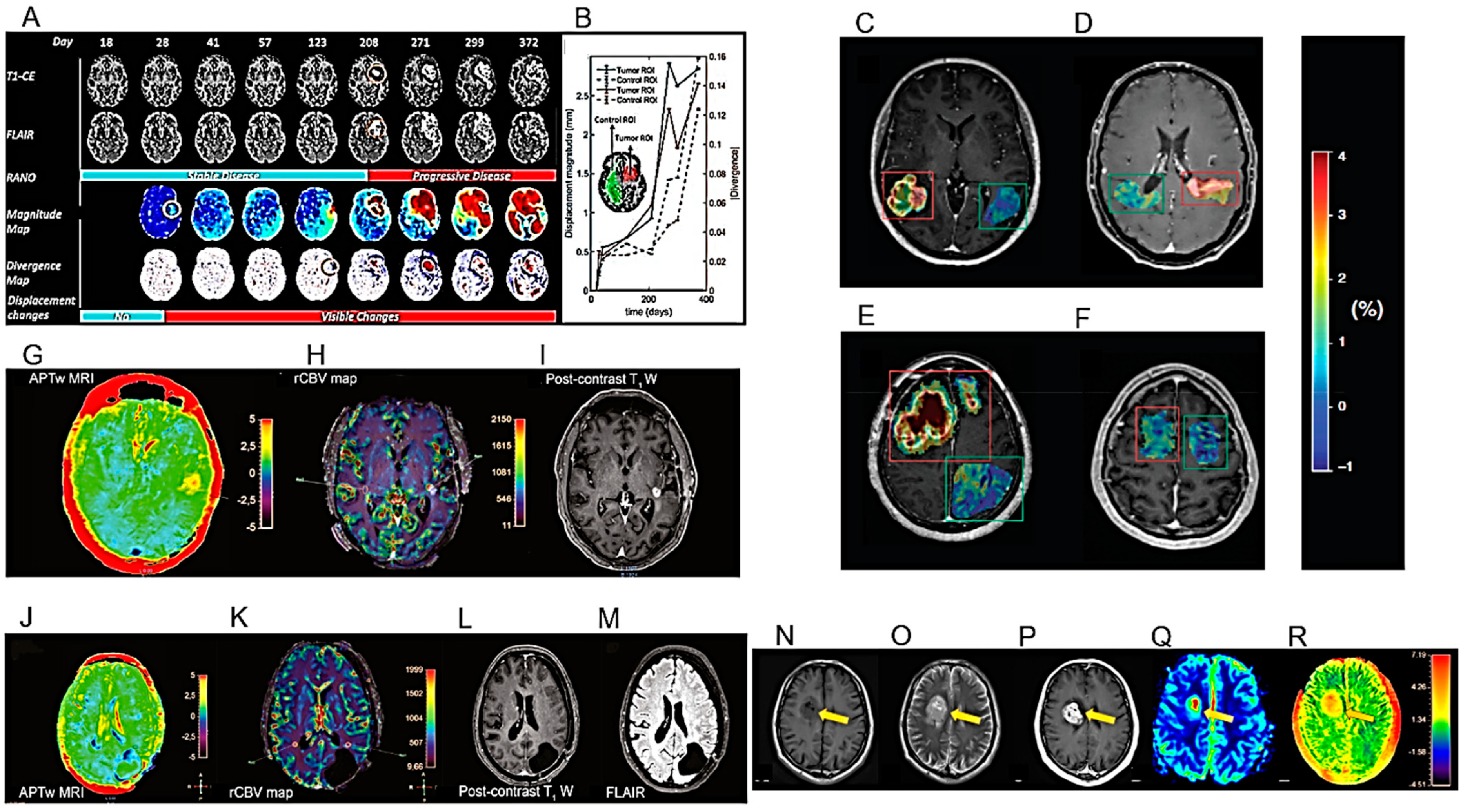 Cancers 16 01566 g003