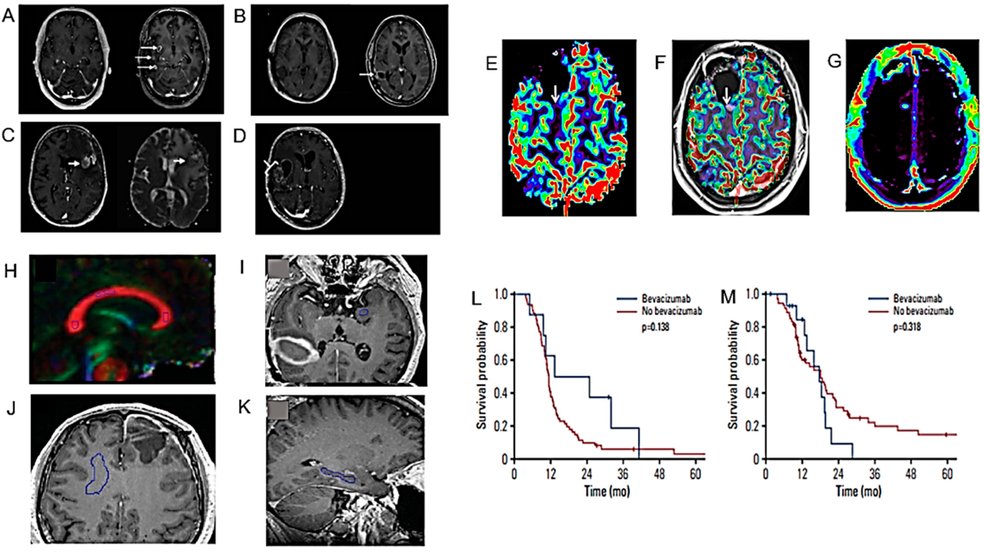 Cancers 16 01566 g005