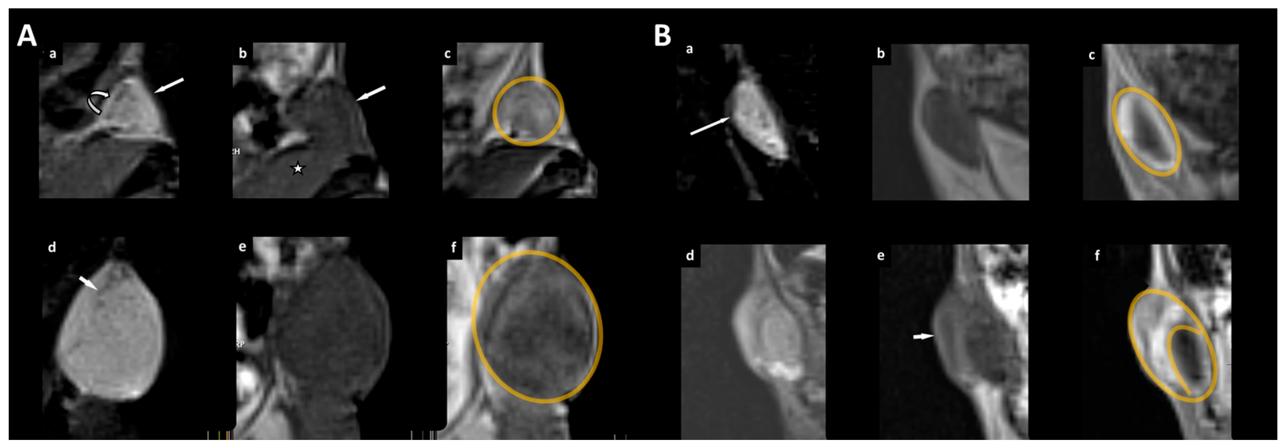 Cancers 16 01591 g005