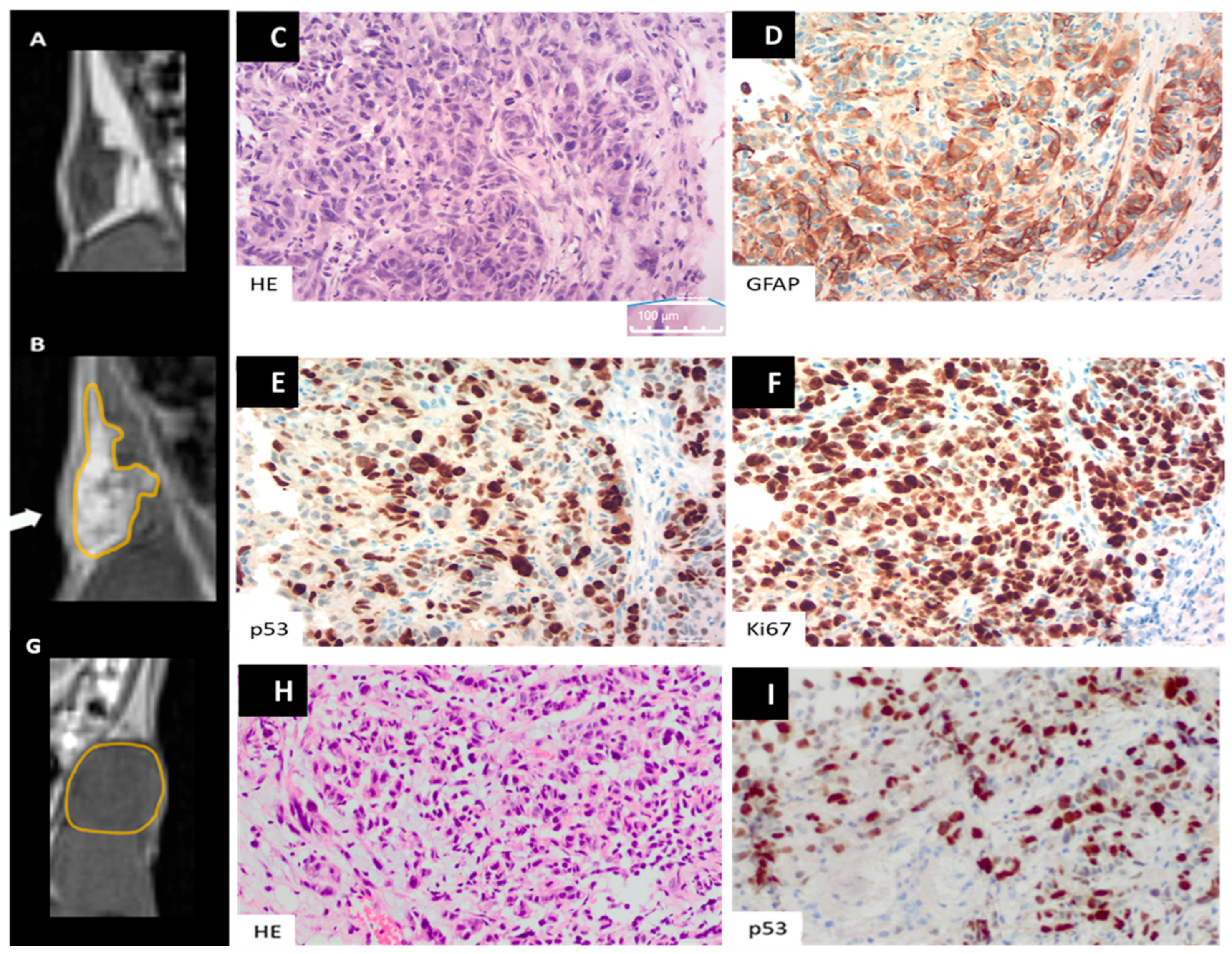 Cancers 16 01591 g006