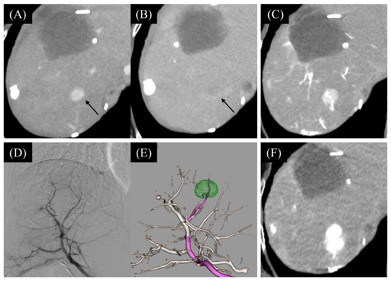Cancers 16 01624 g004