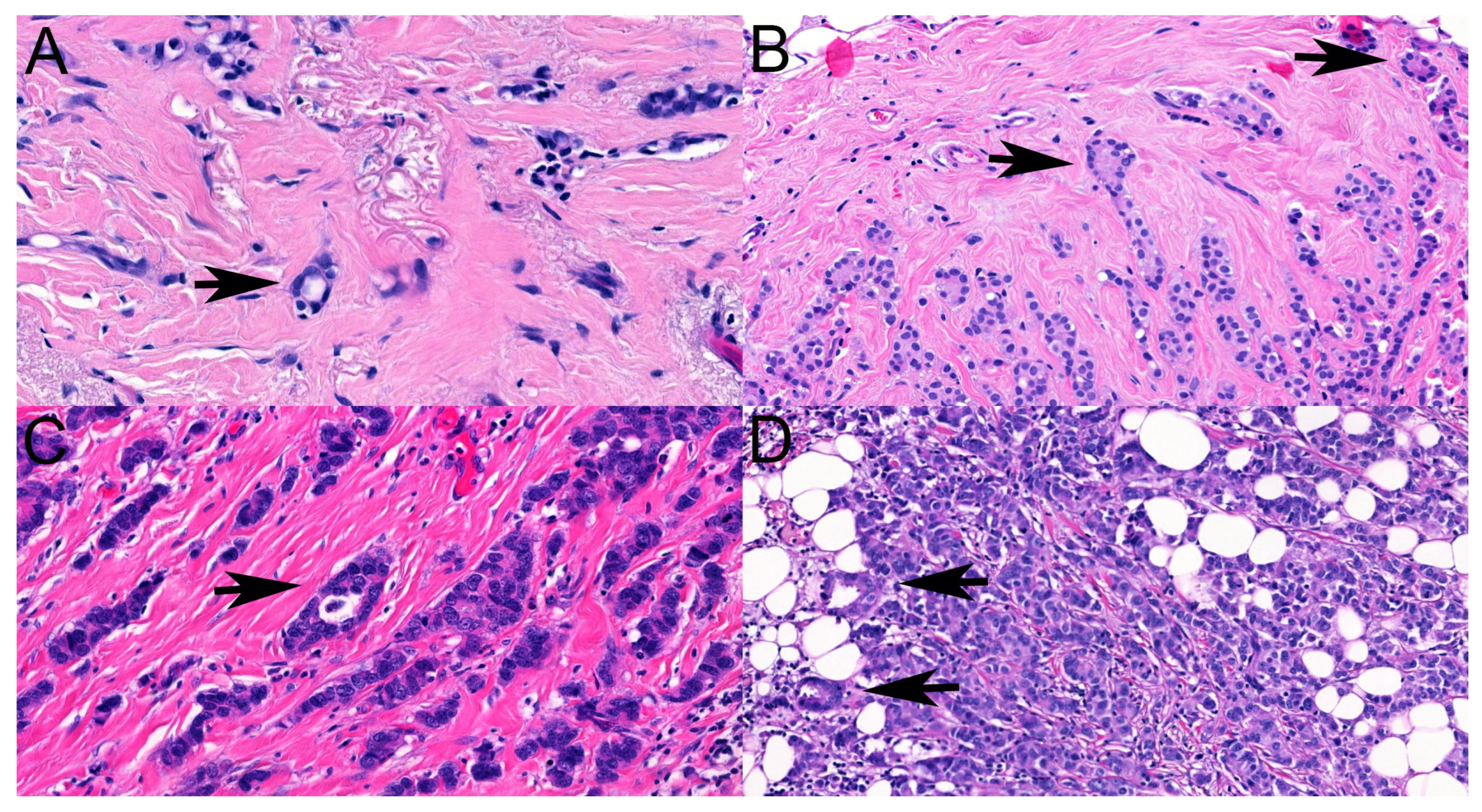 Cancers 16 01640 g003