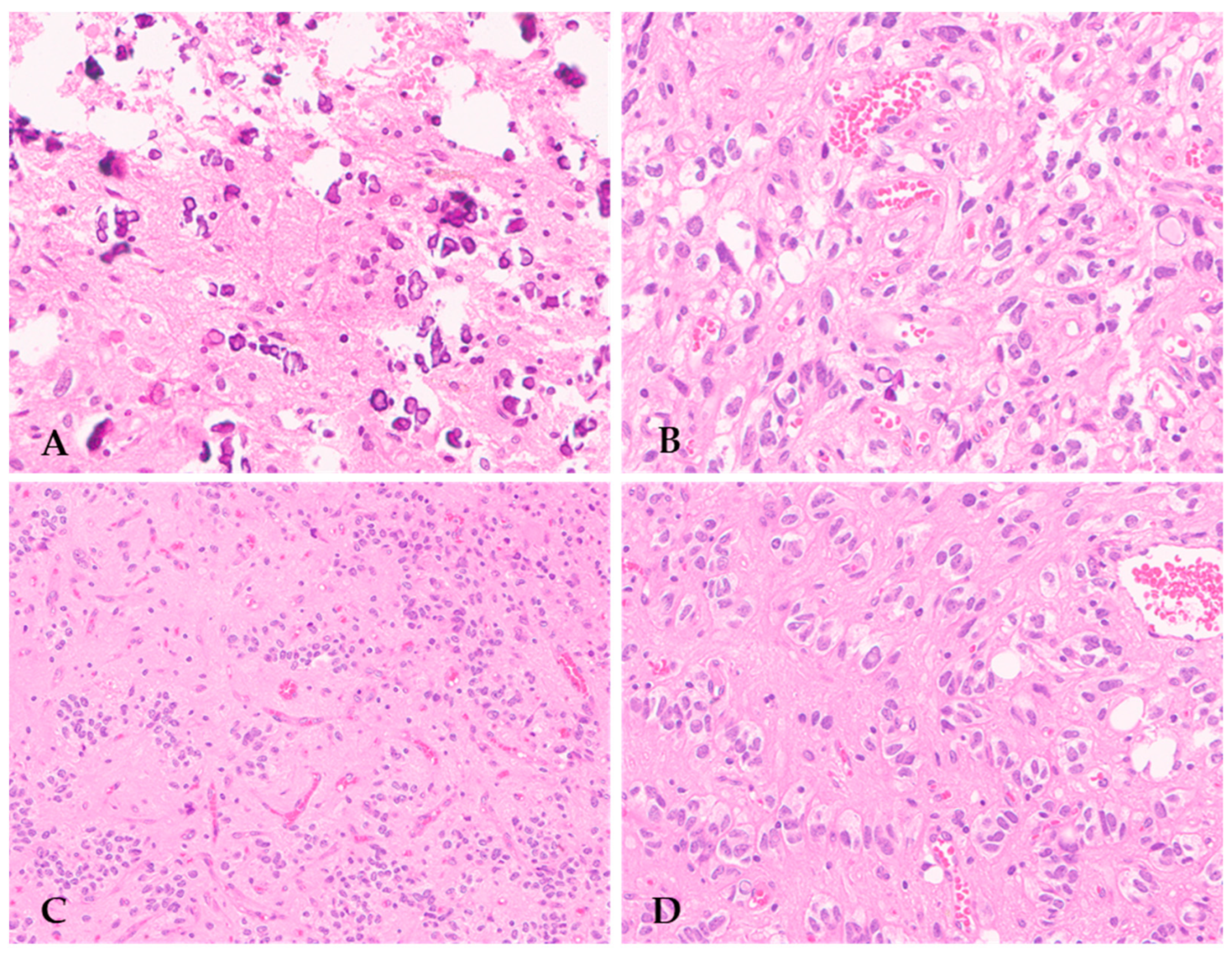 Cancers 16 01644 g001