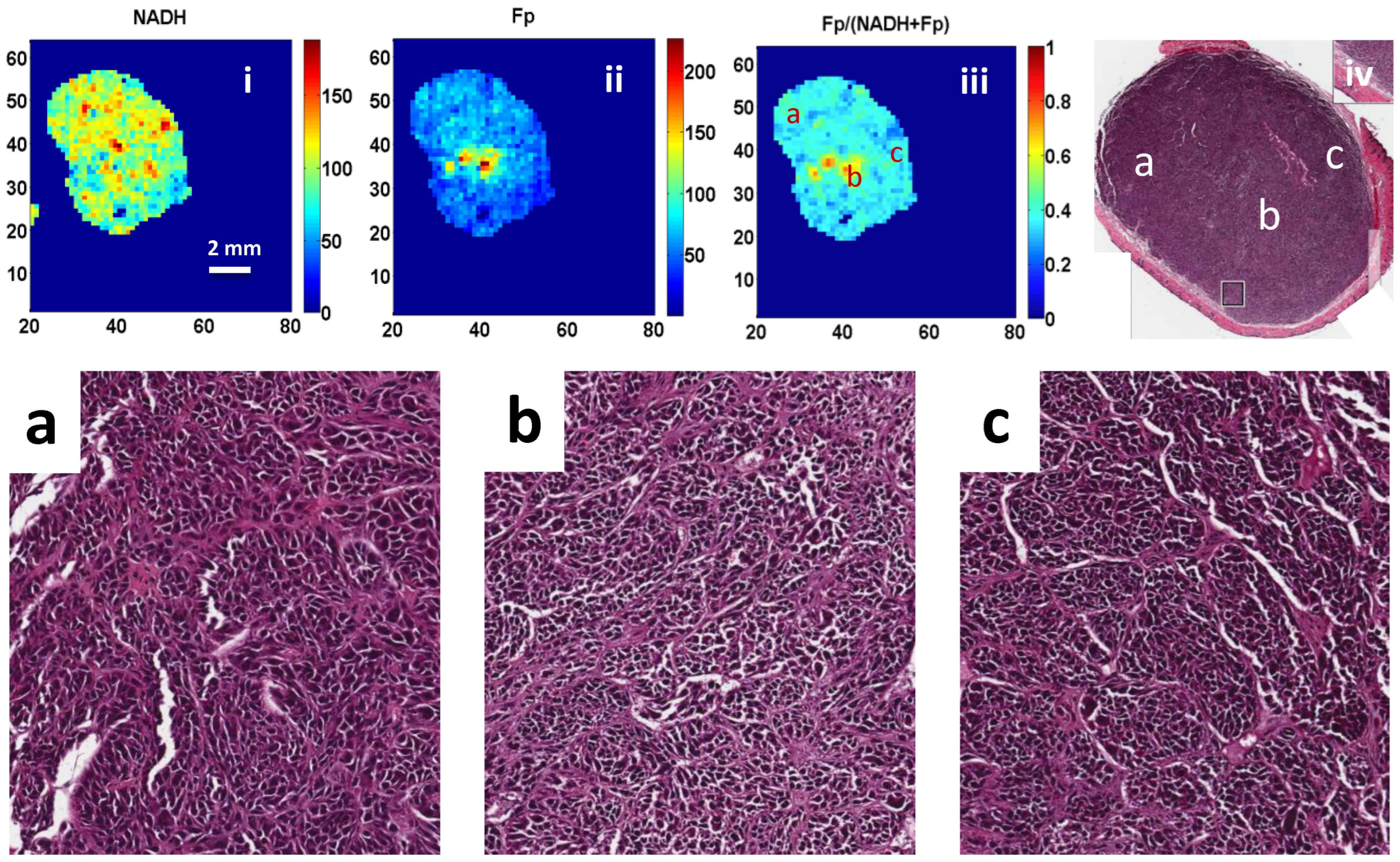 Cancers 16 01669 g003