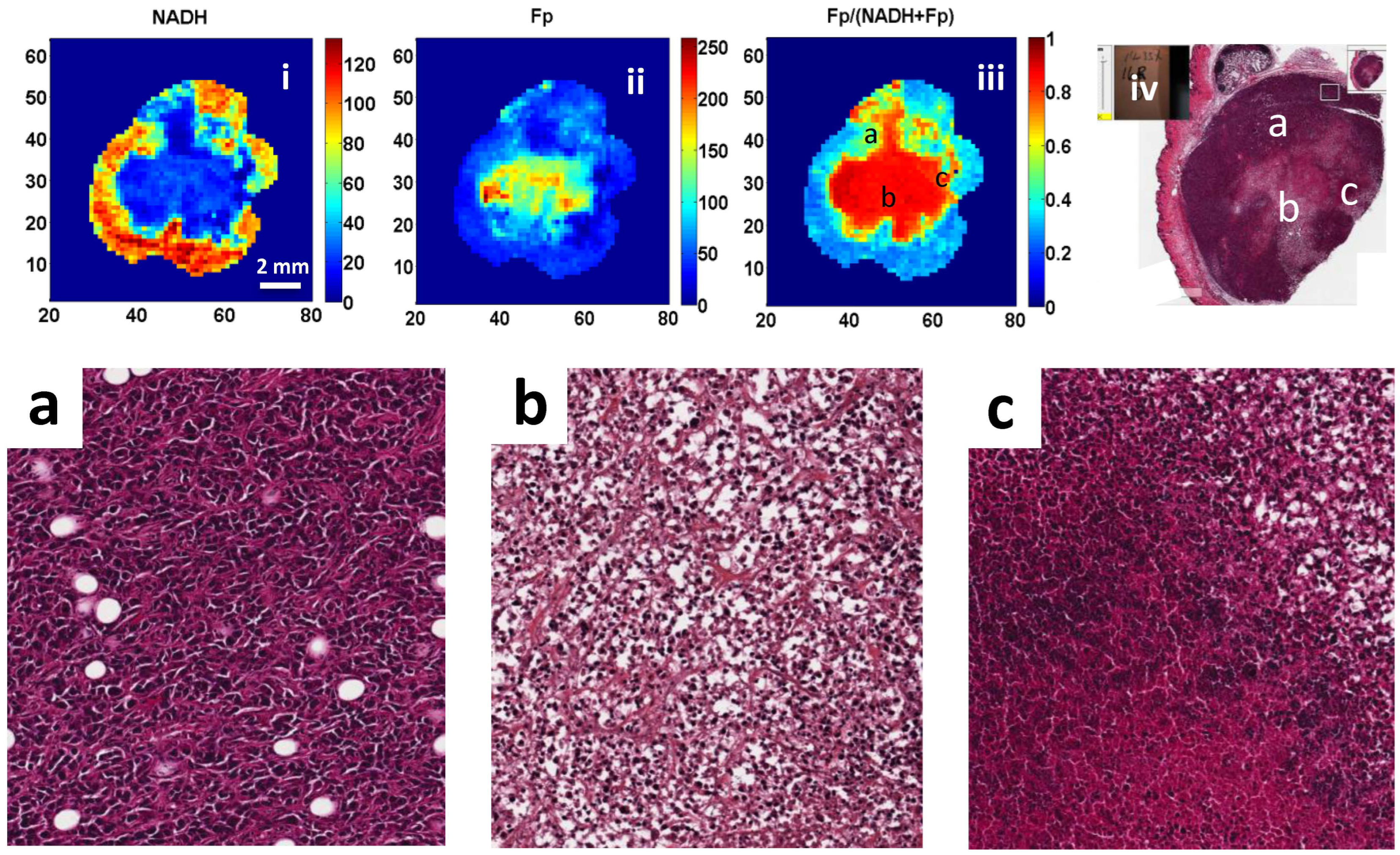 Cancers 16 01669 g004