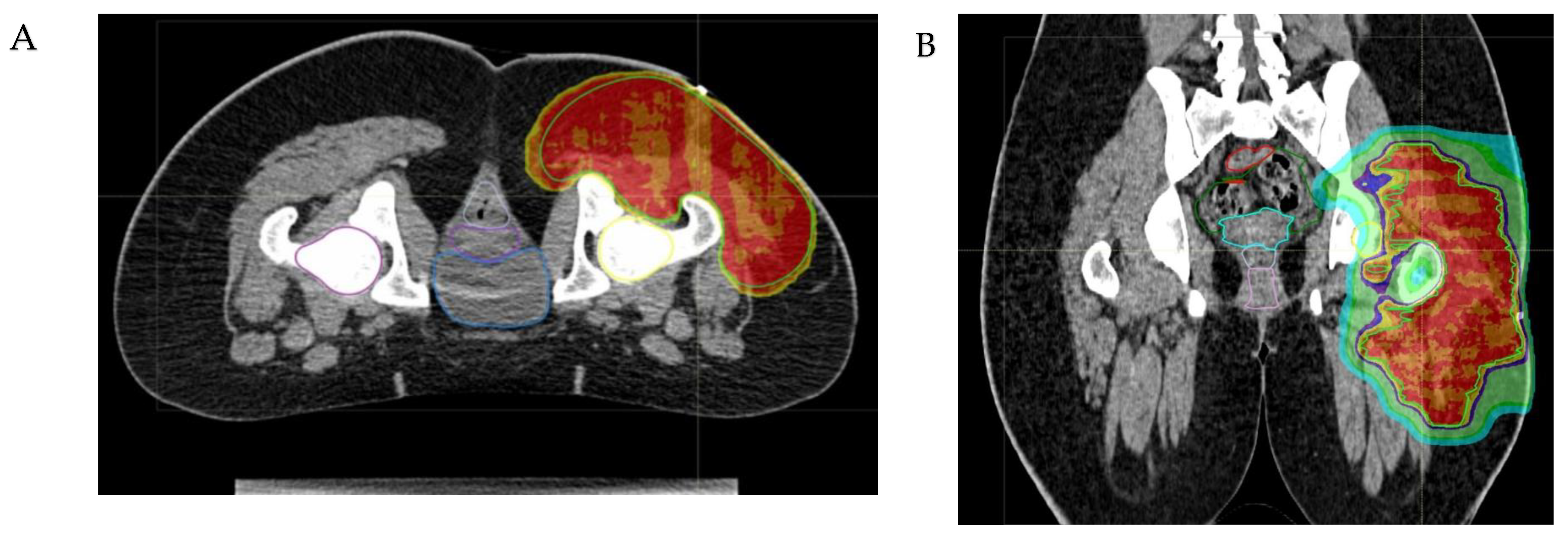 Cancers 16 01694 g003