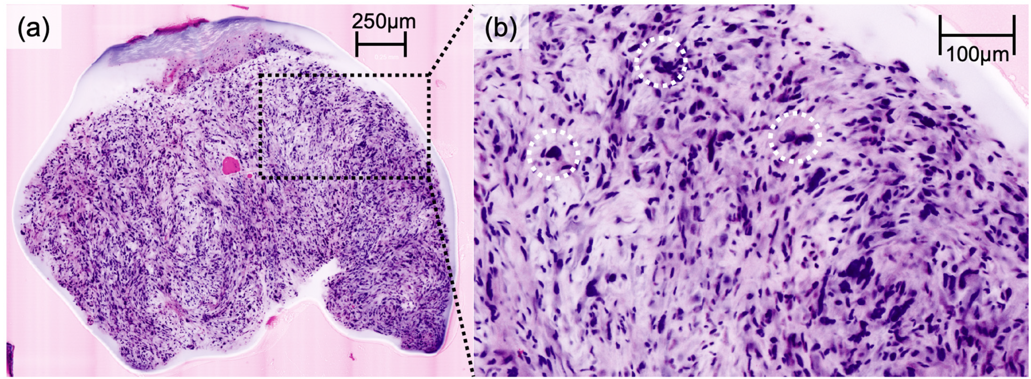 Cancers 16 01713 g002