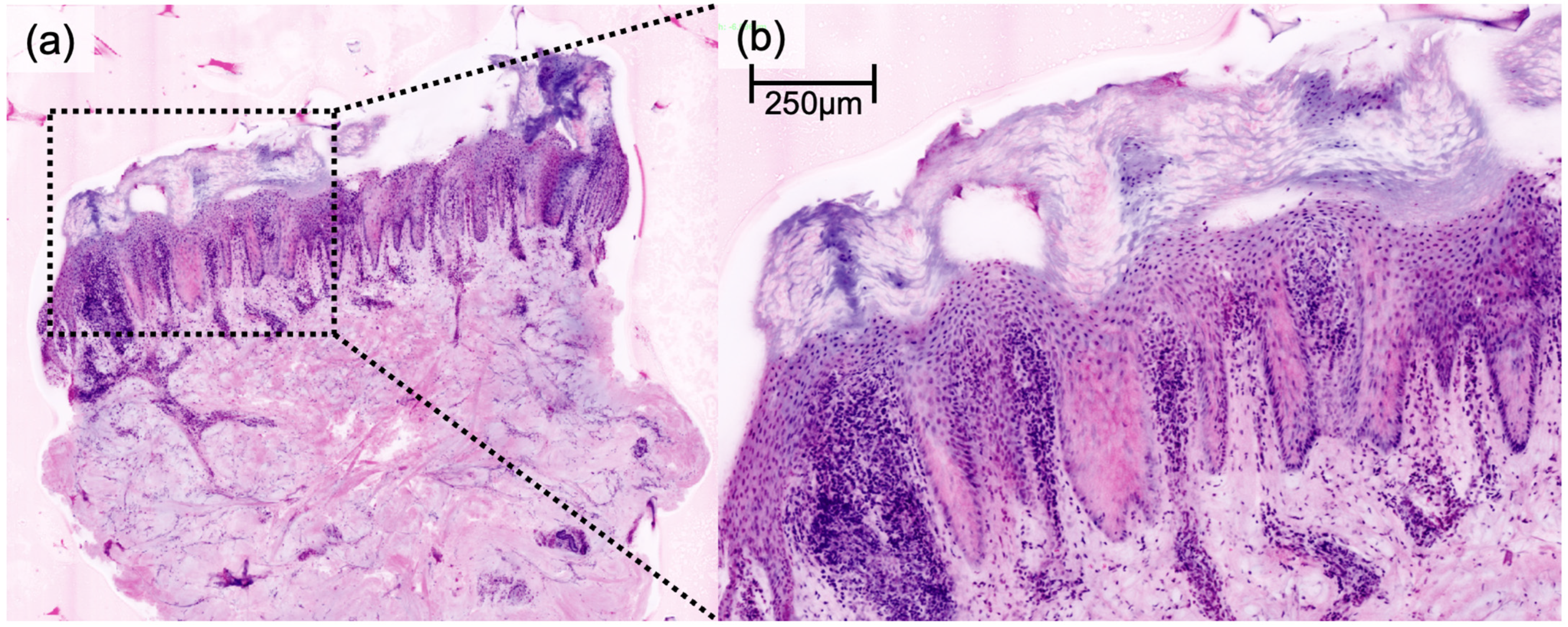 Cancers 16 01713 g005