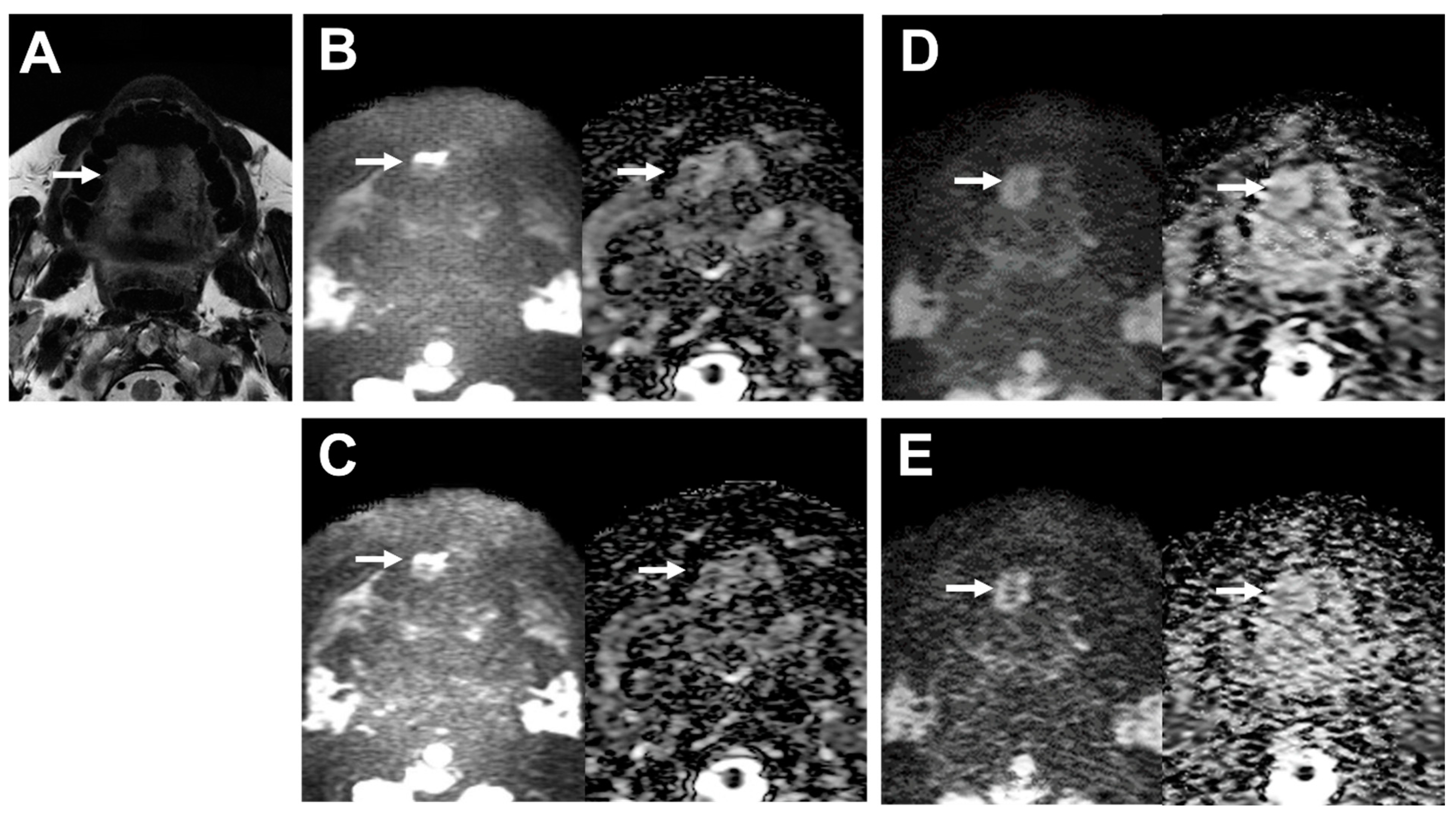 Cancers 16 01714 g003