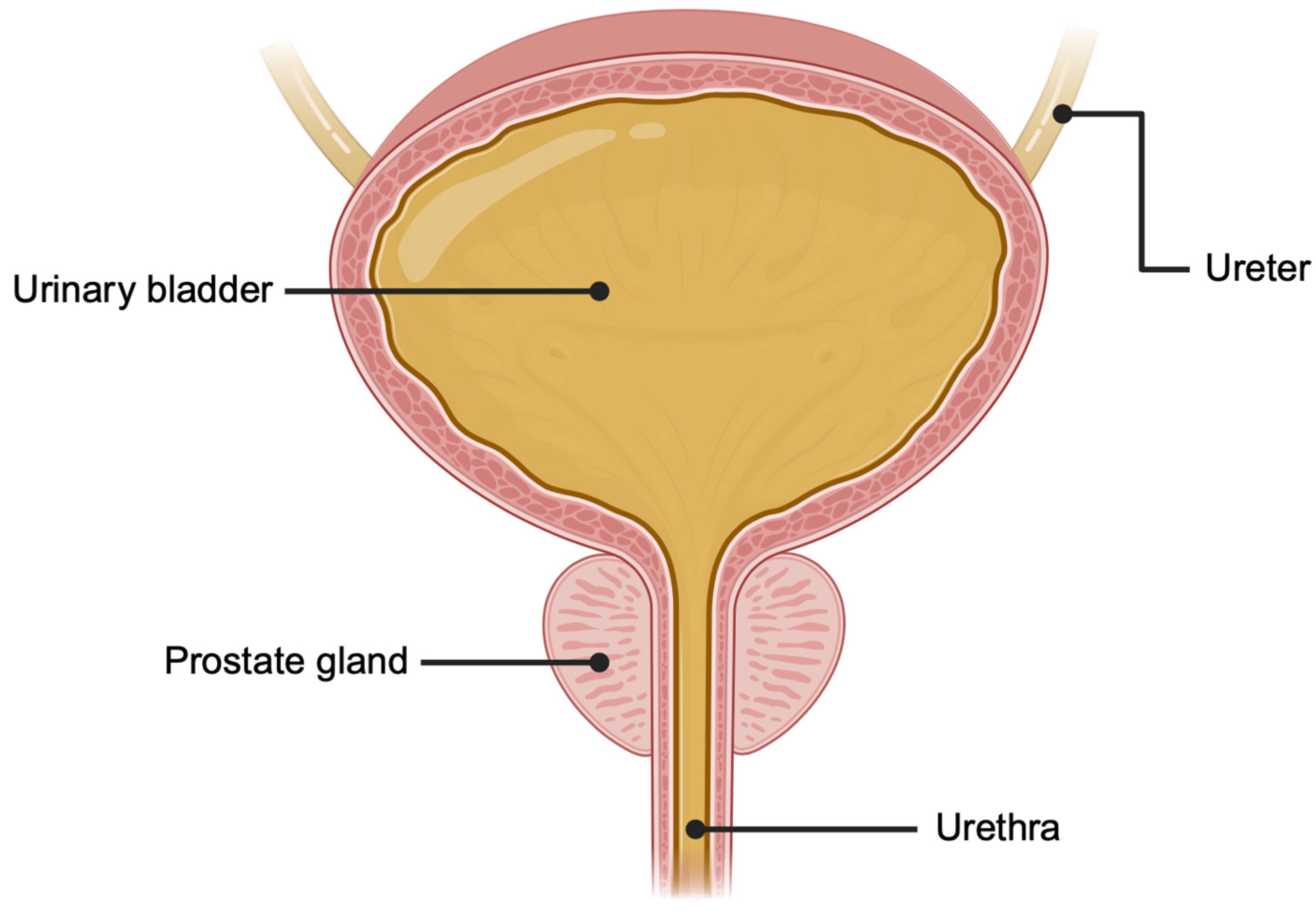 Cancers 16 01717 g001
