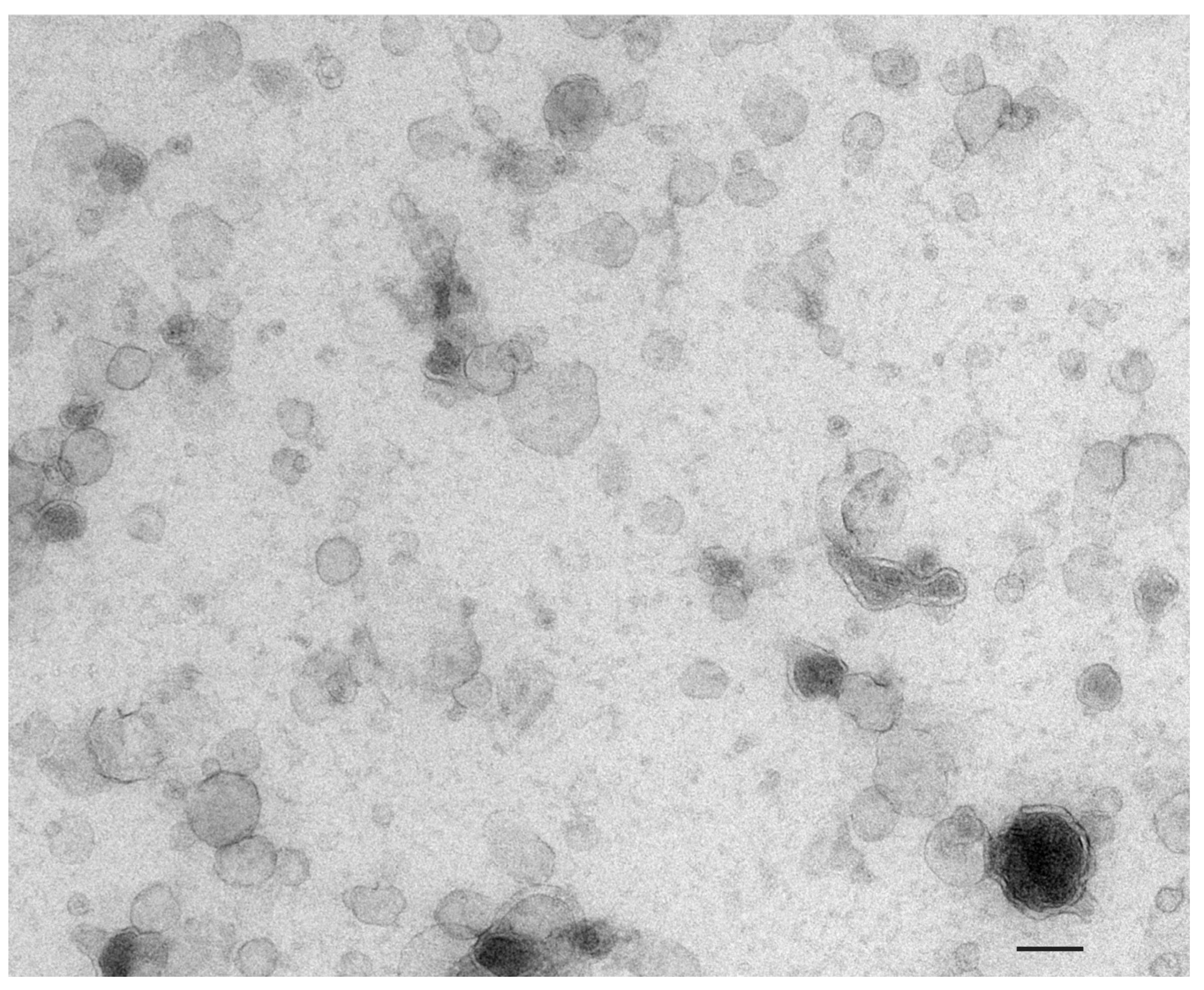 Cancers 16 01717 g002