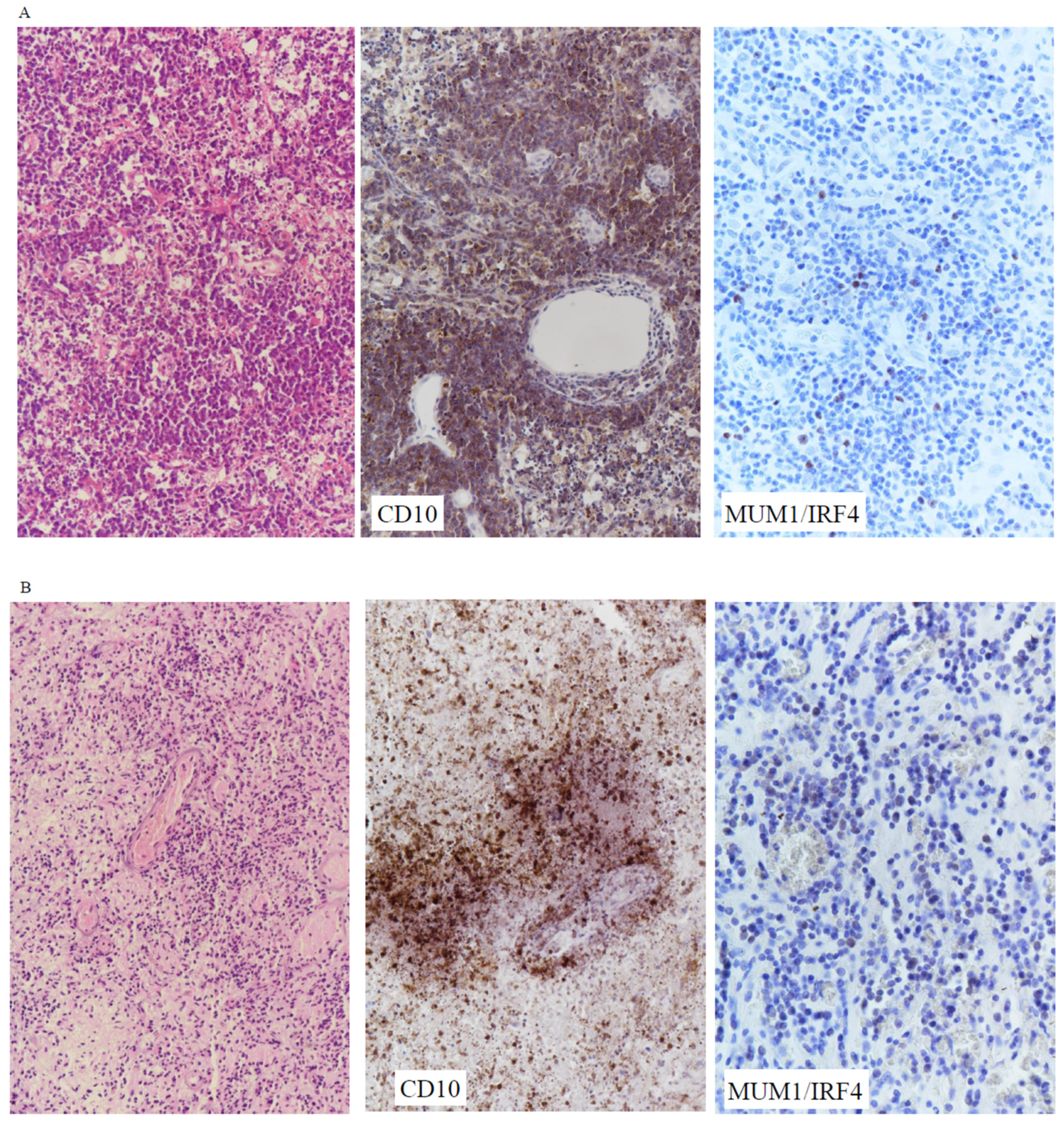 Cancers 16 01740 g002a