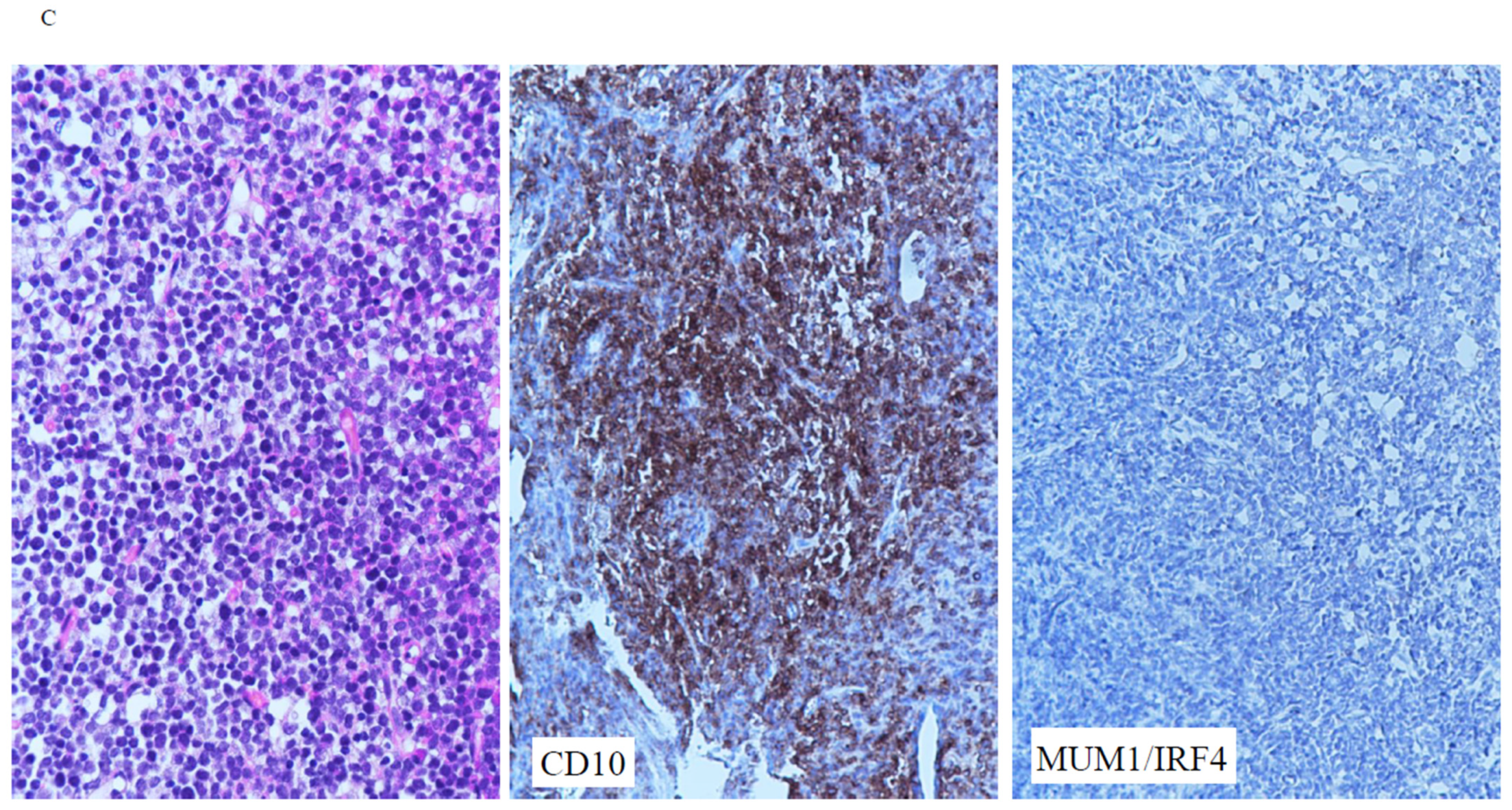 Cancers 16 01740 g002b