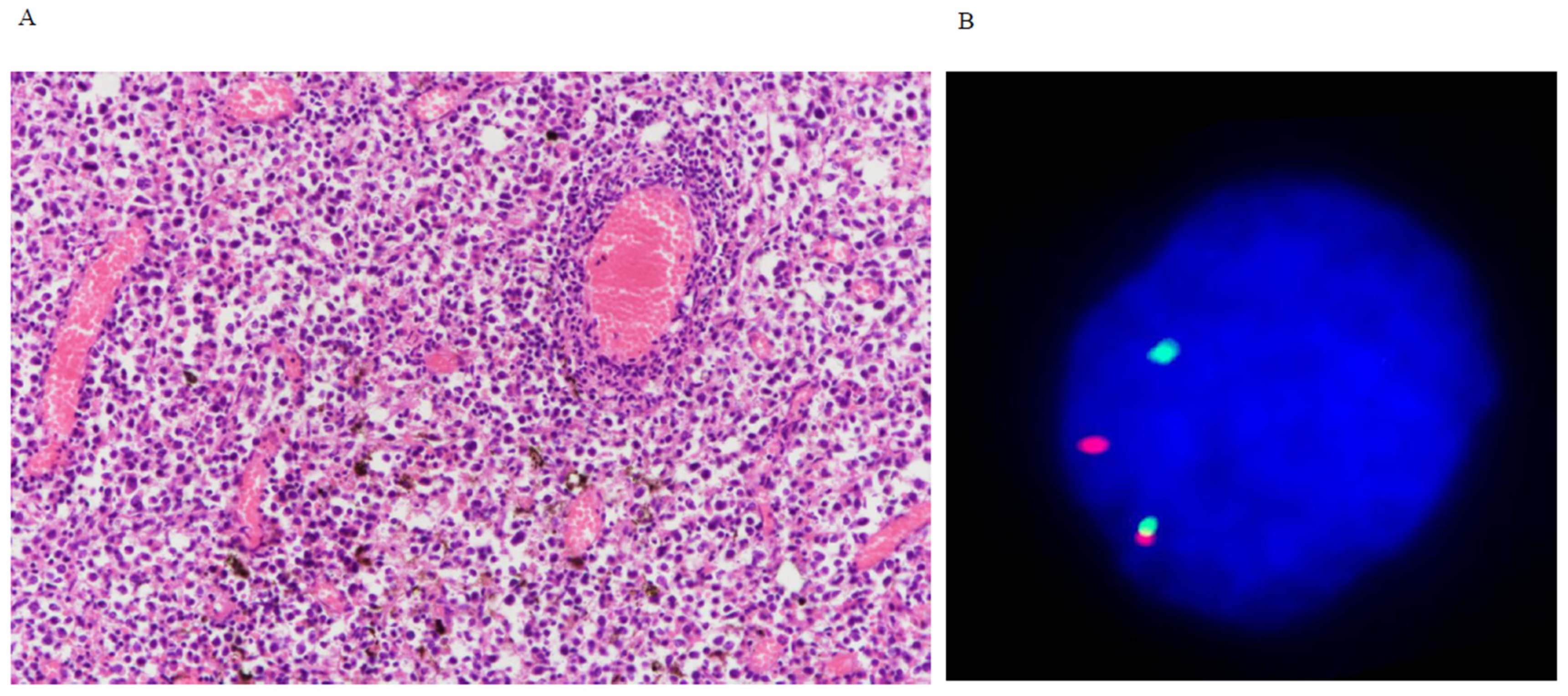 Cancers 16 01740 g003