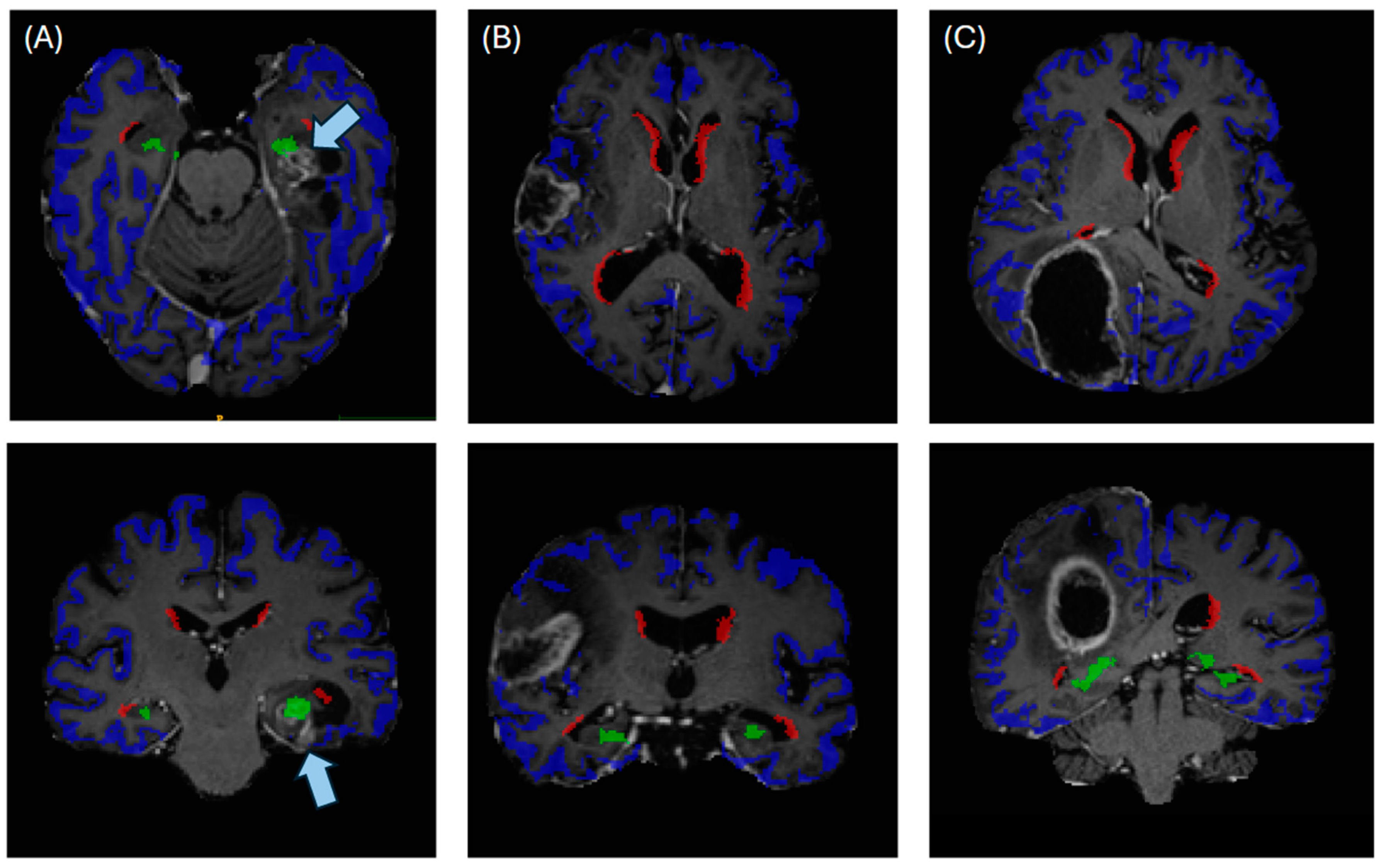 Cancers 16 01743 g002