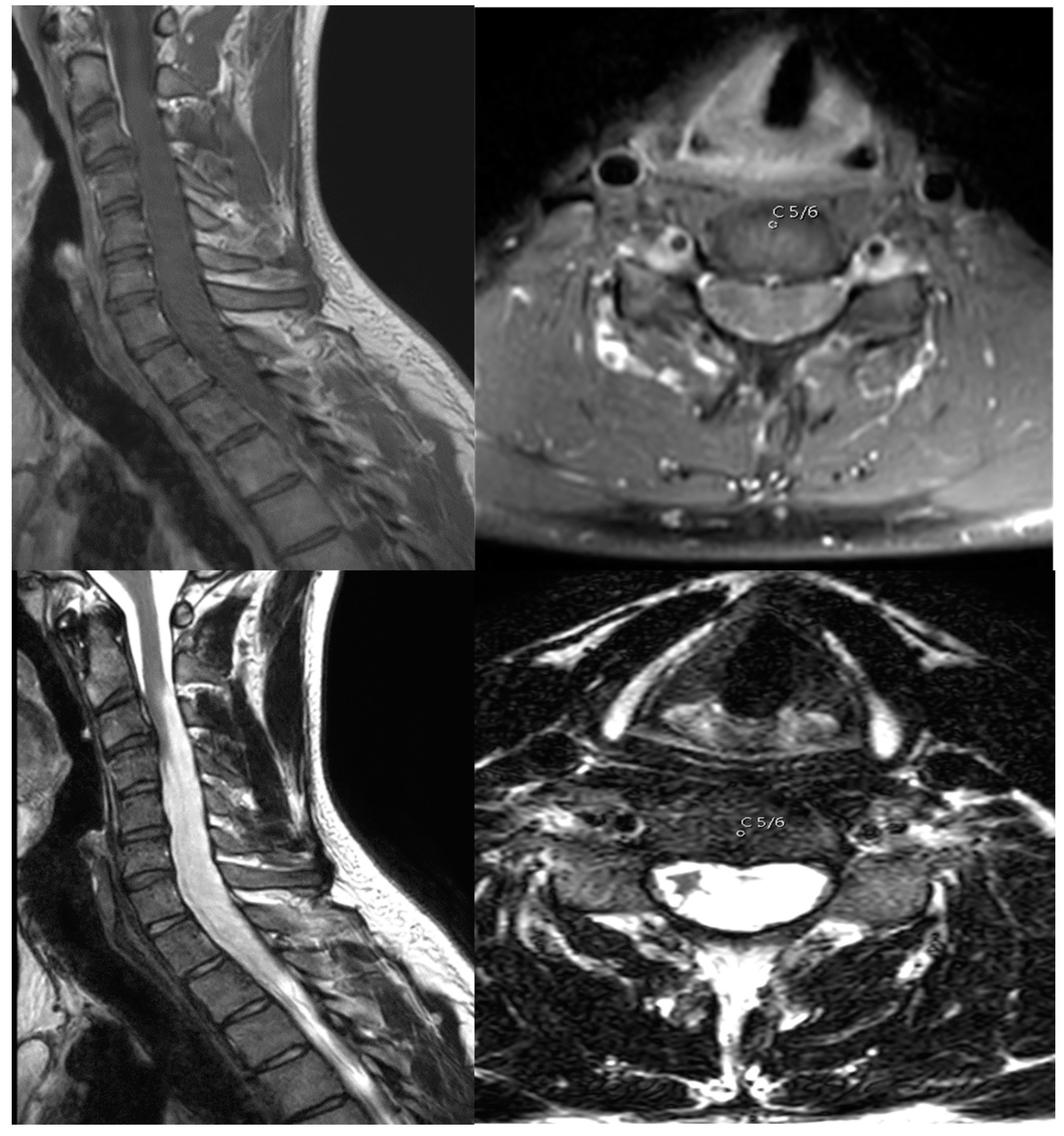 Cancers 16 01782 g001